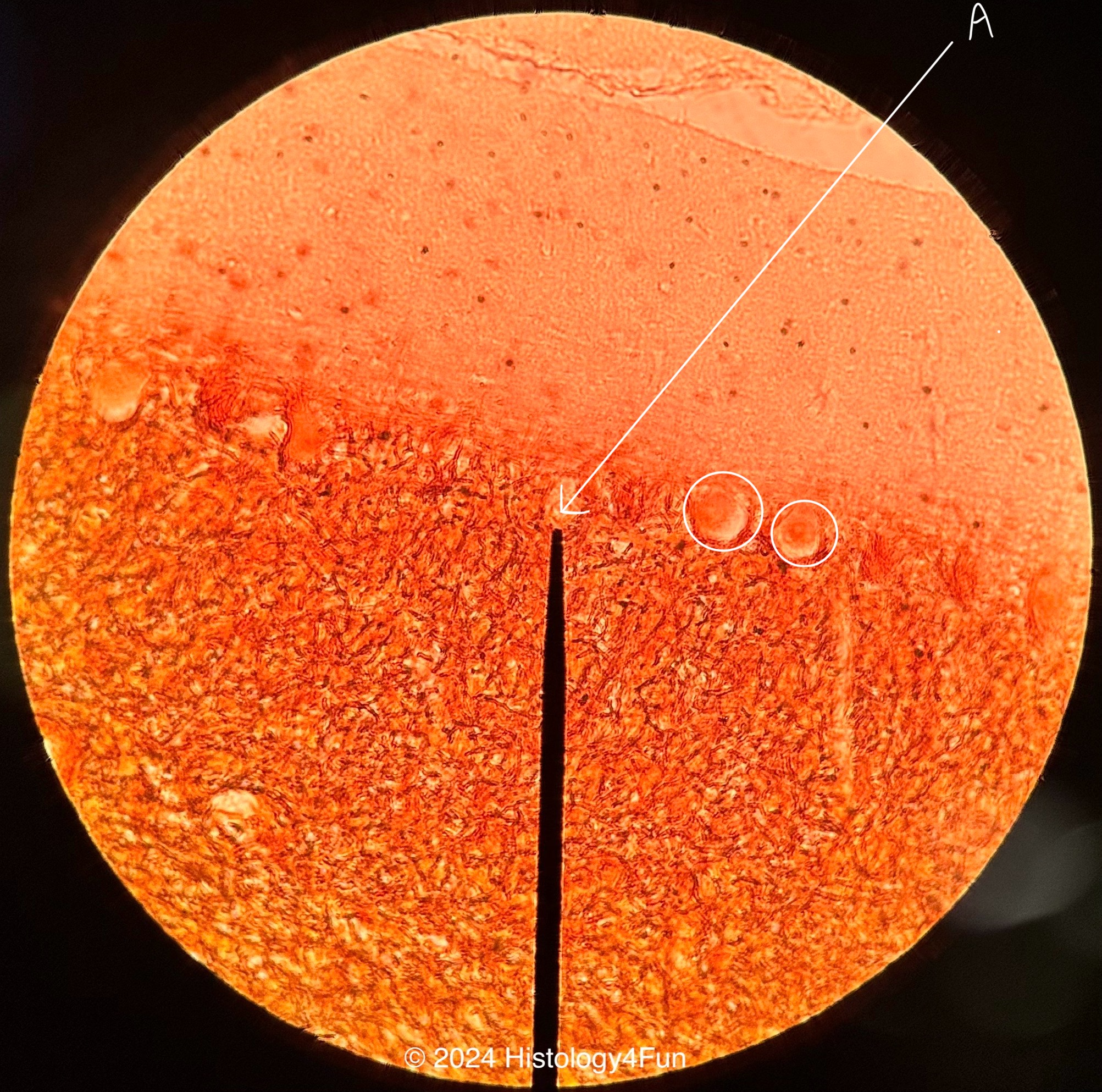 Purkinje Cells - Cerebrum 