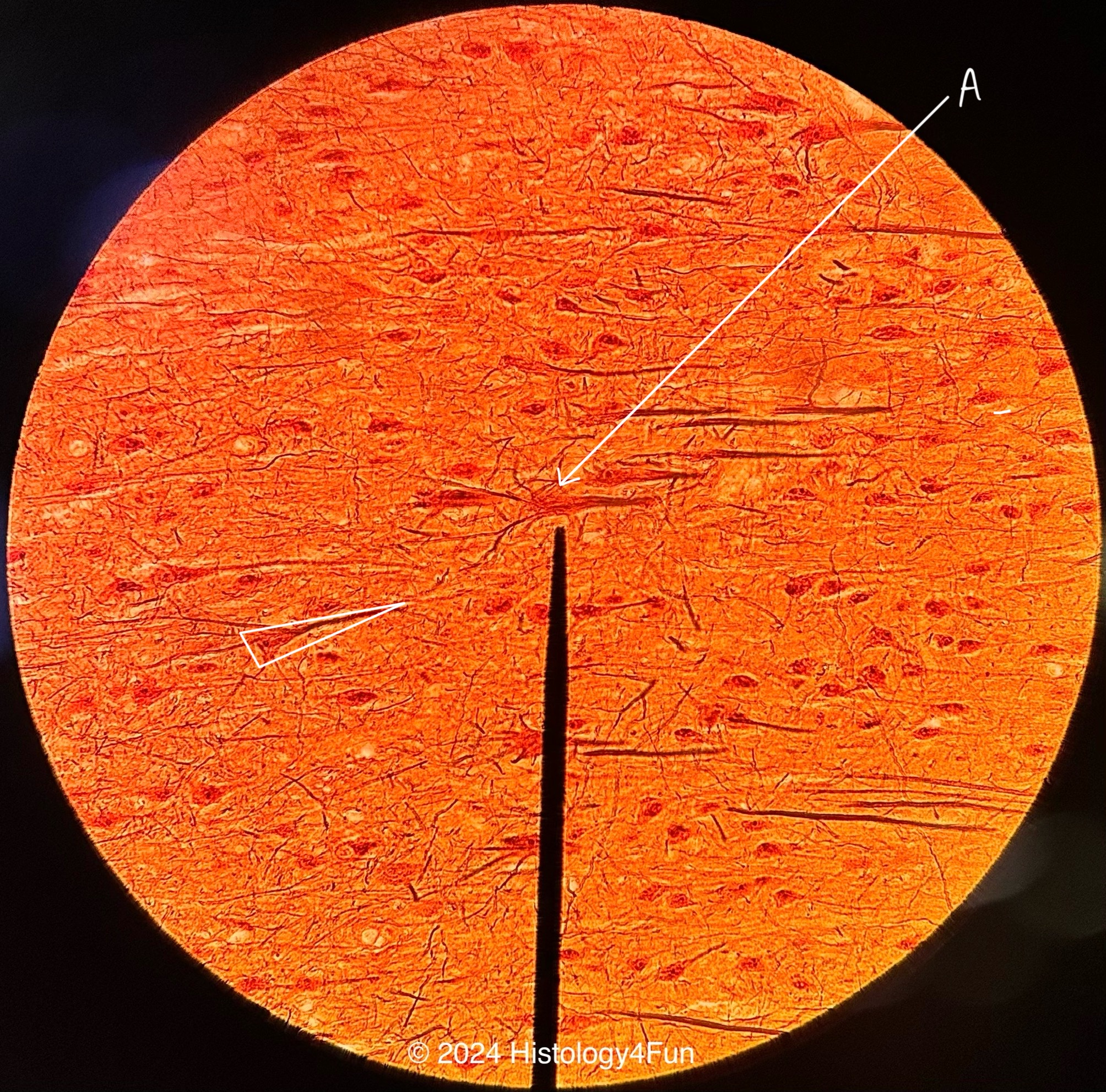 Pyramidal Cells - Cerebral Cortex 