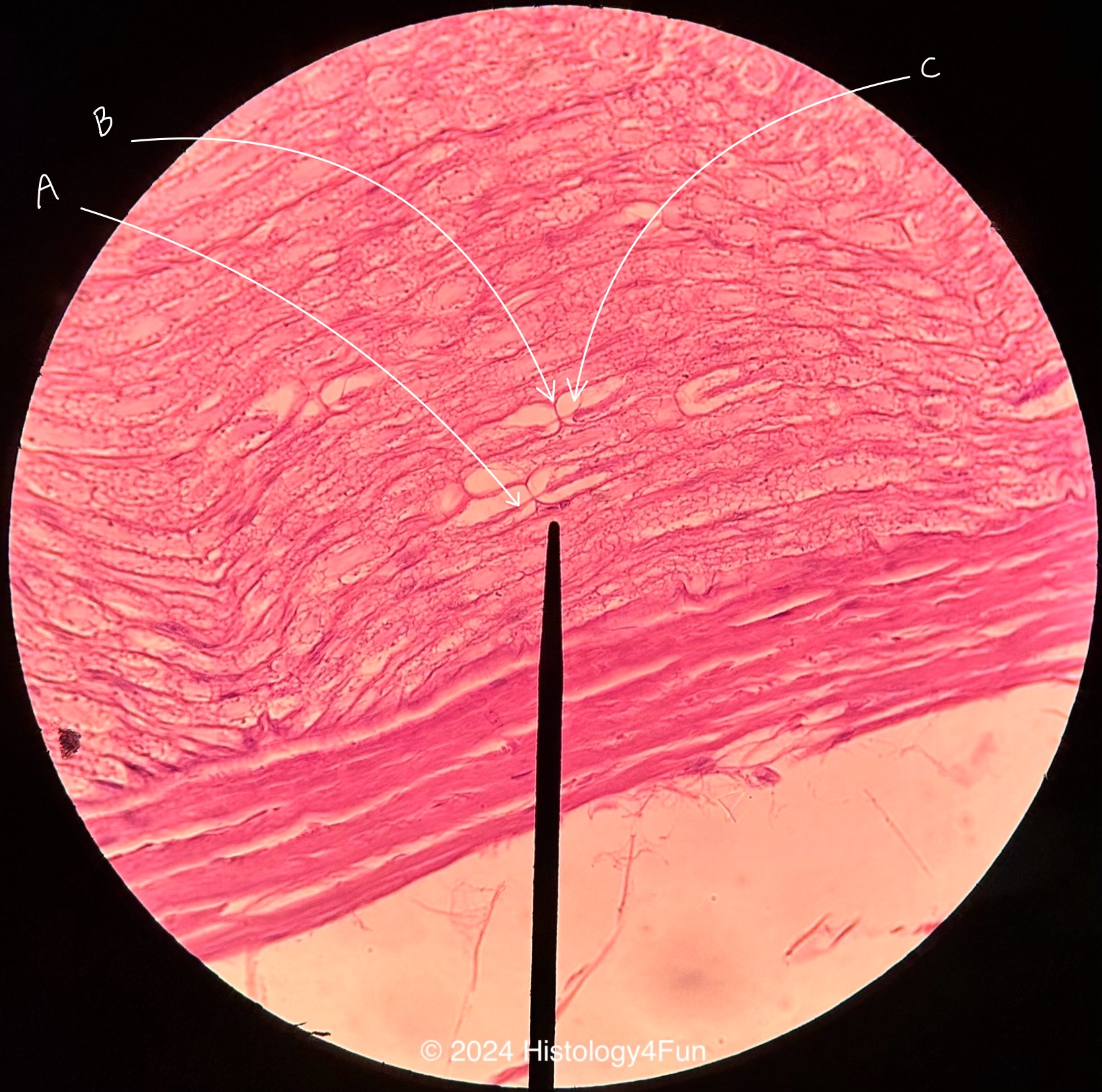 Peripheral Nerve Cross Section 