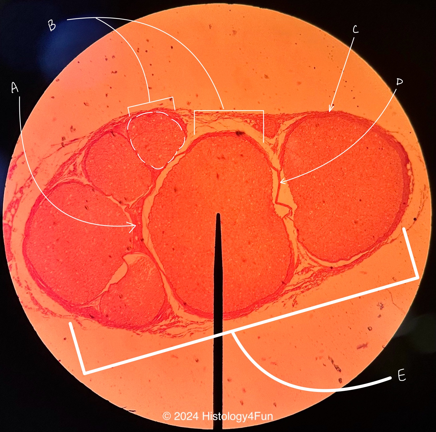 Peripheral Nerve Longitudinal View 20x