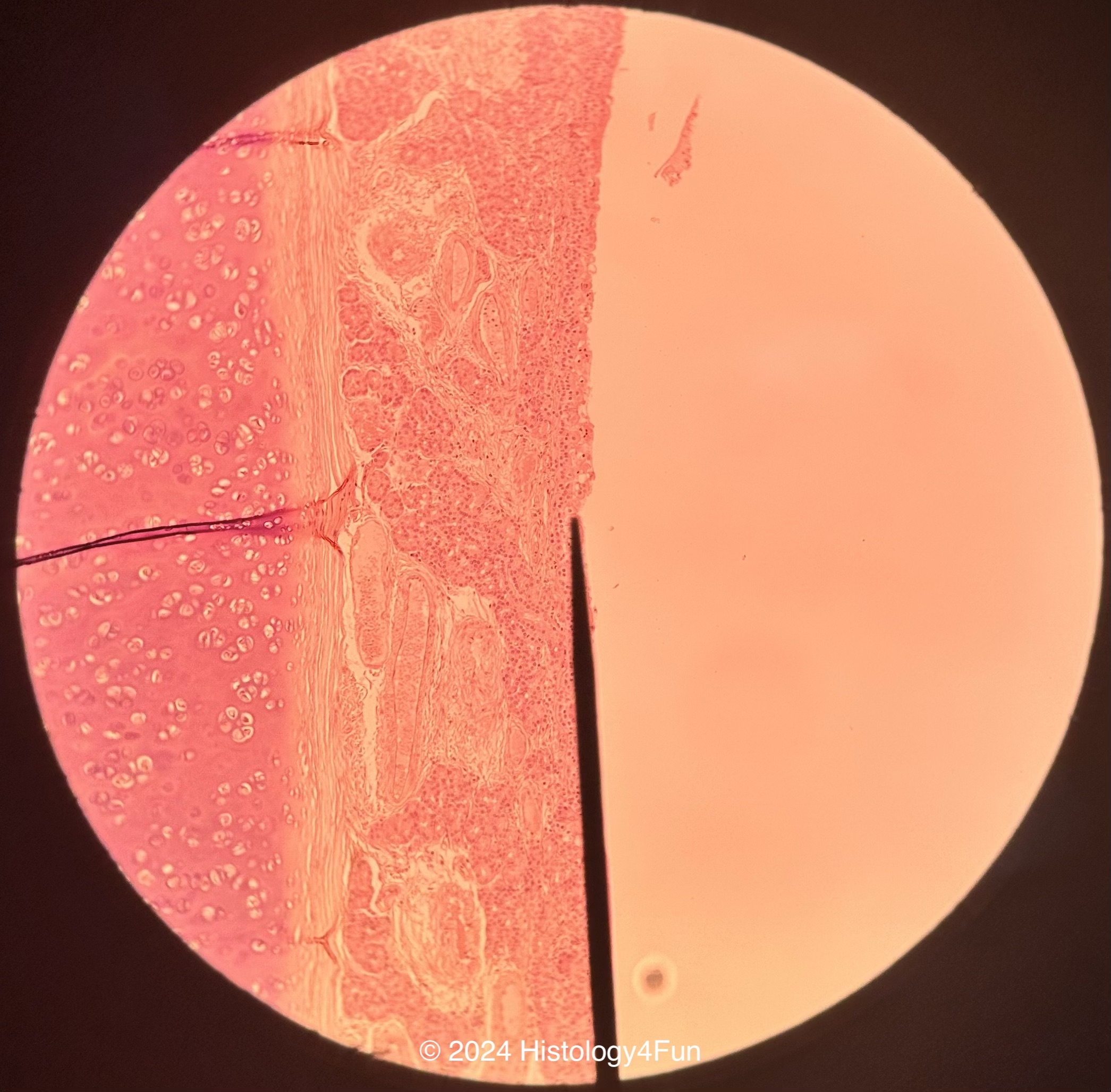 Olfactory Epithelium 