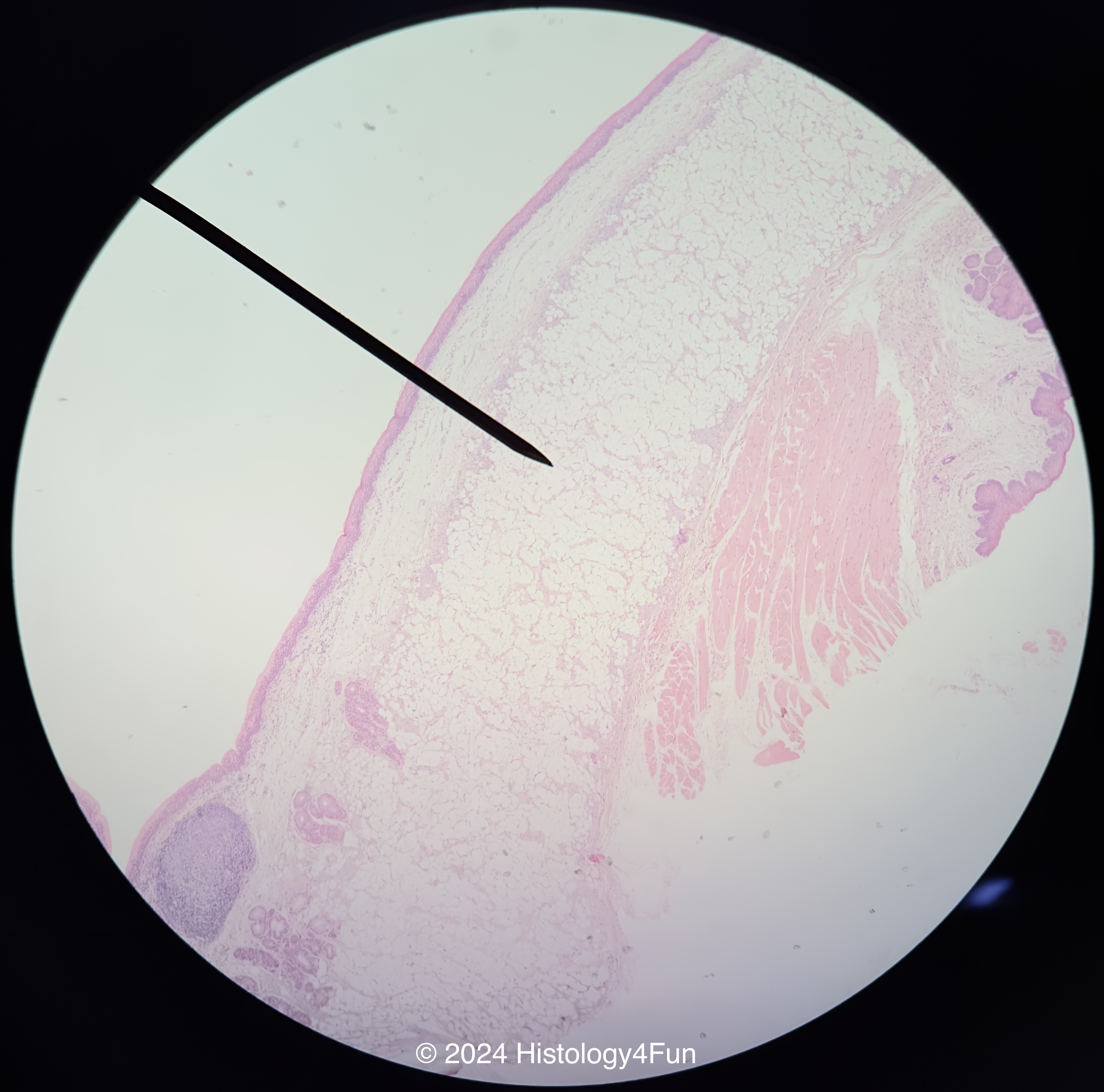 Adipose Tissue 