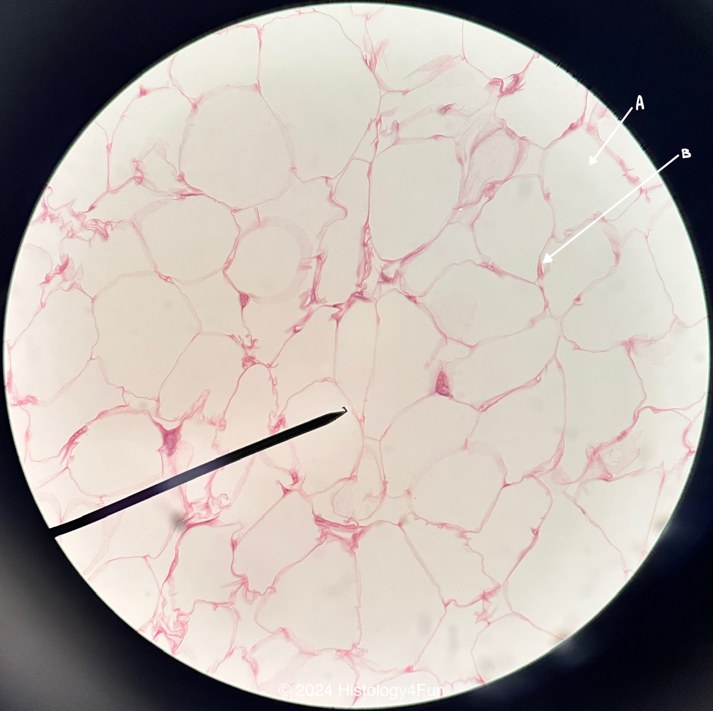 Adipose Tissue