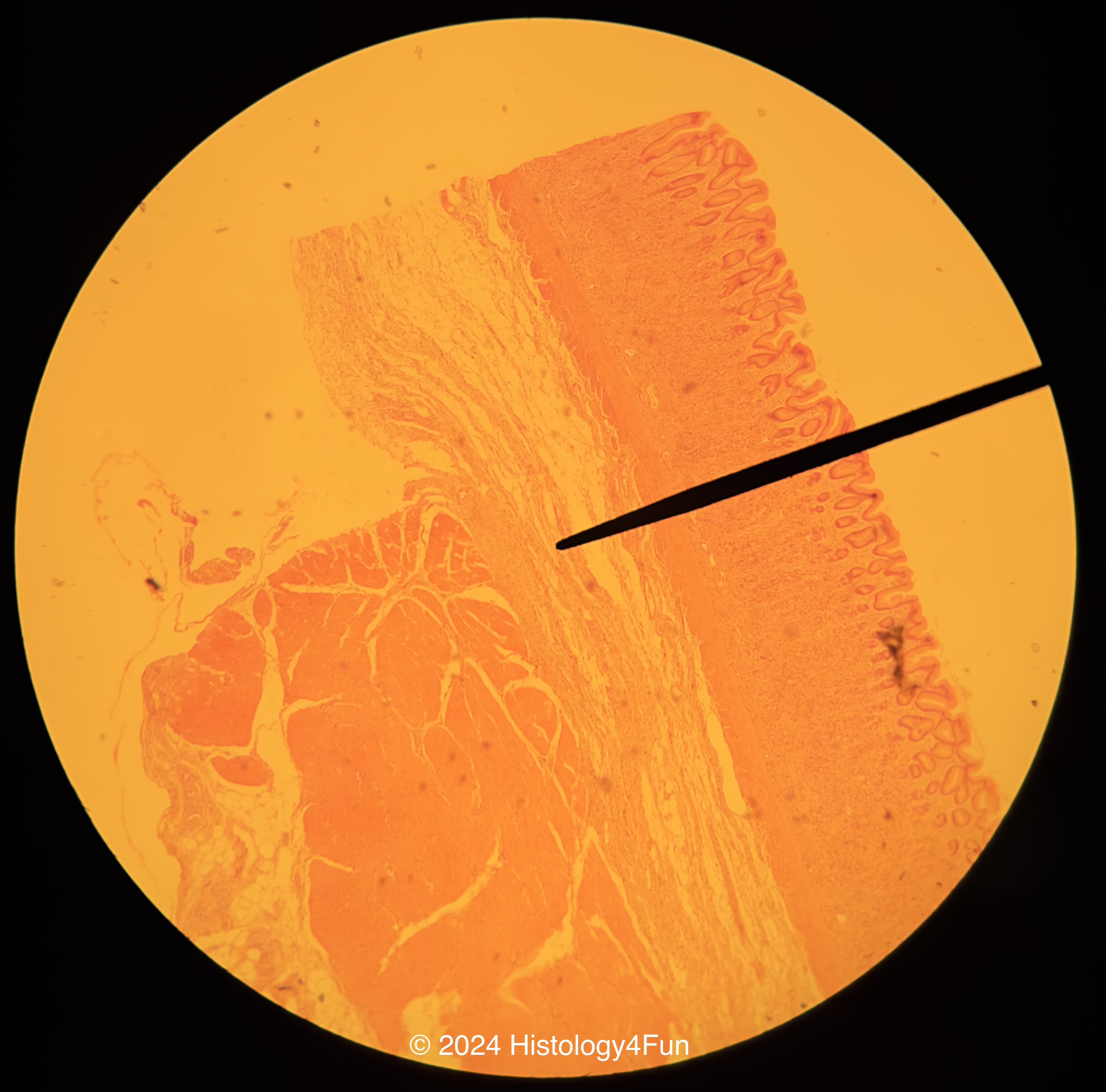 Circular Muscles of Stomach
