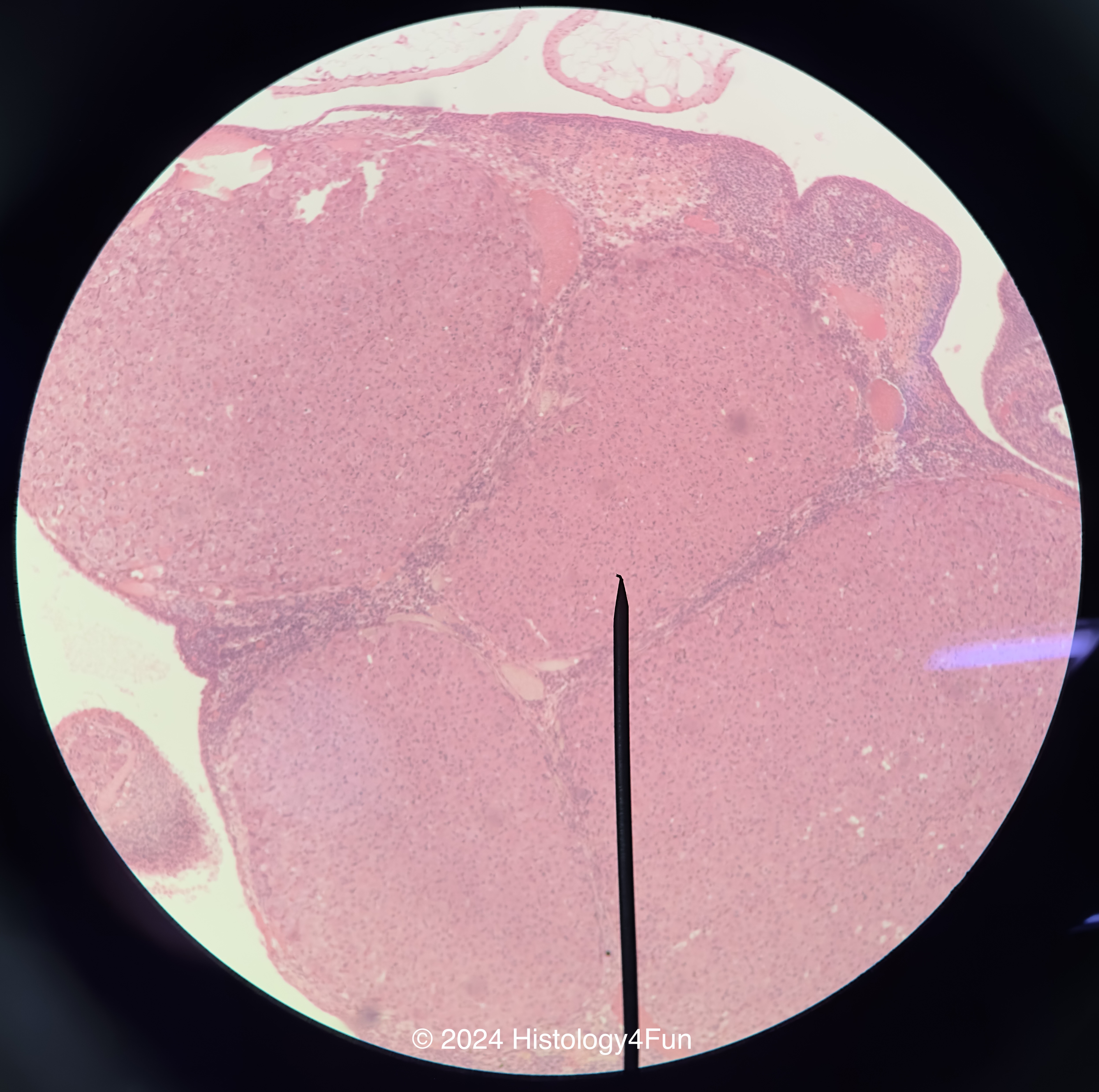 Corpus Luteum