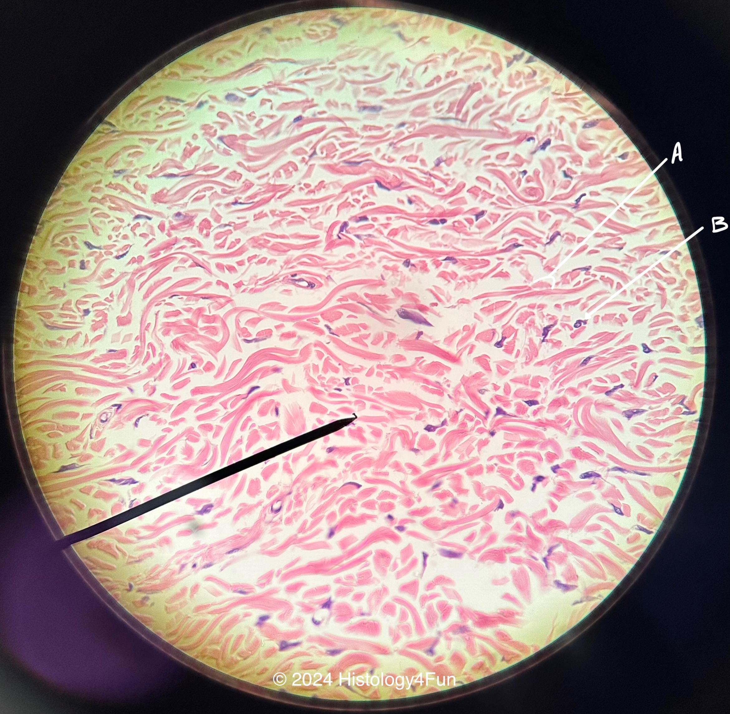 Dense Irregular Connective Tissue