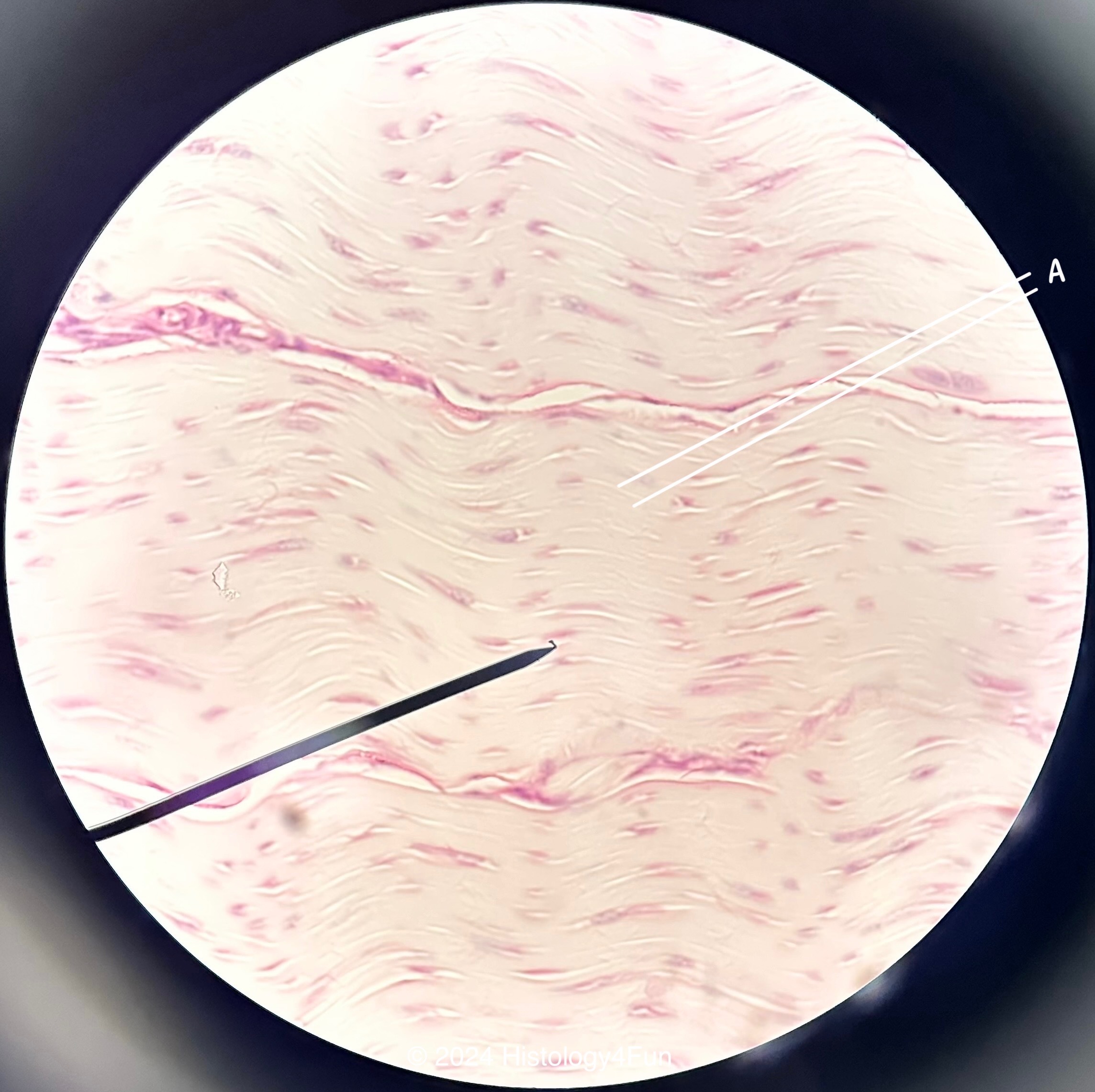 Dense Regular Connective Tissue