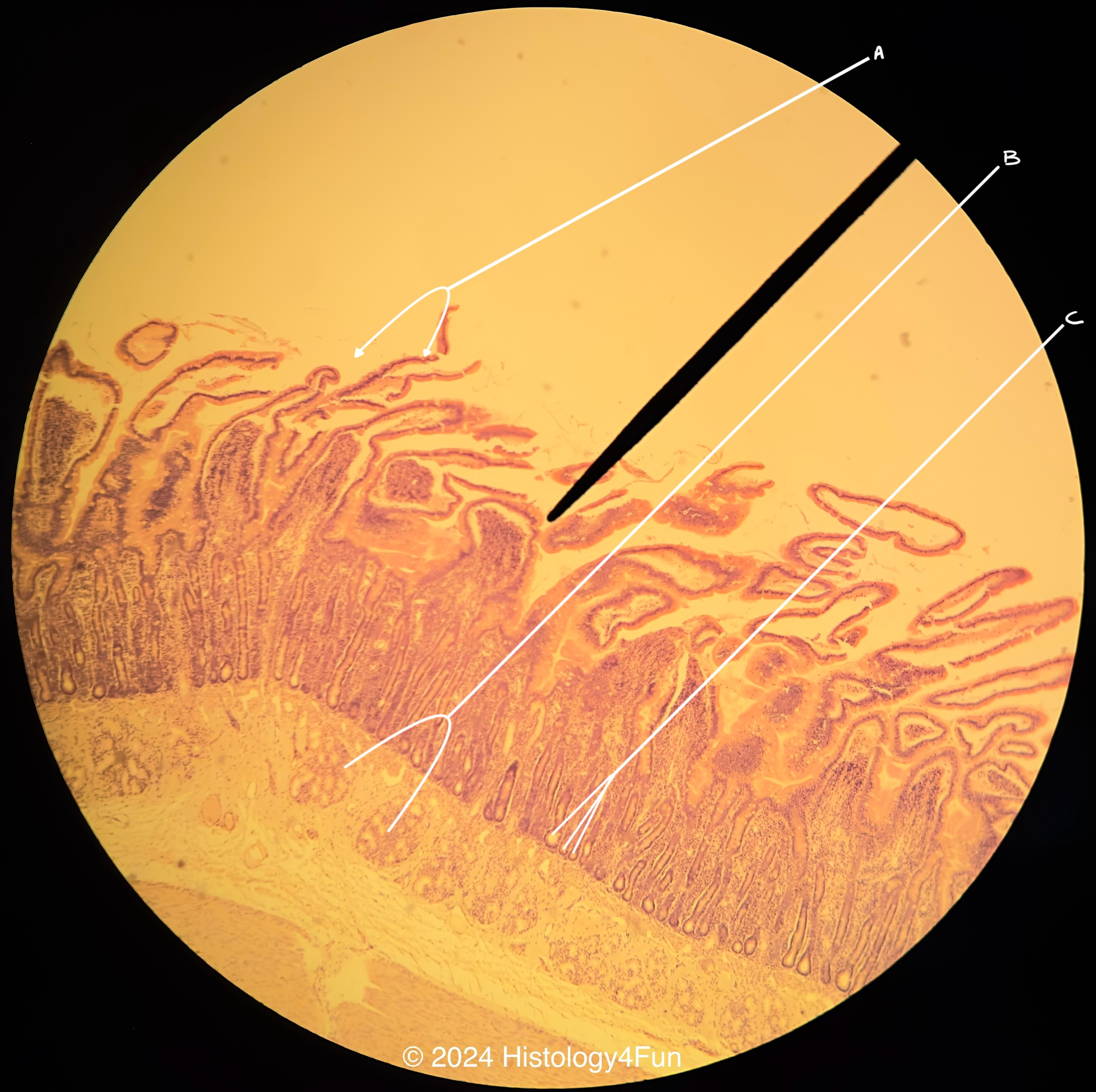 Small Intestines - Duodenum