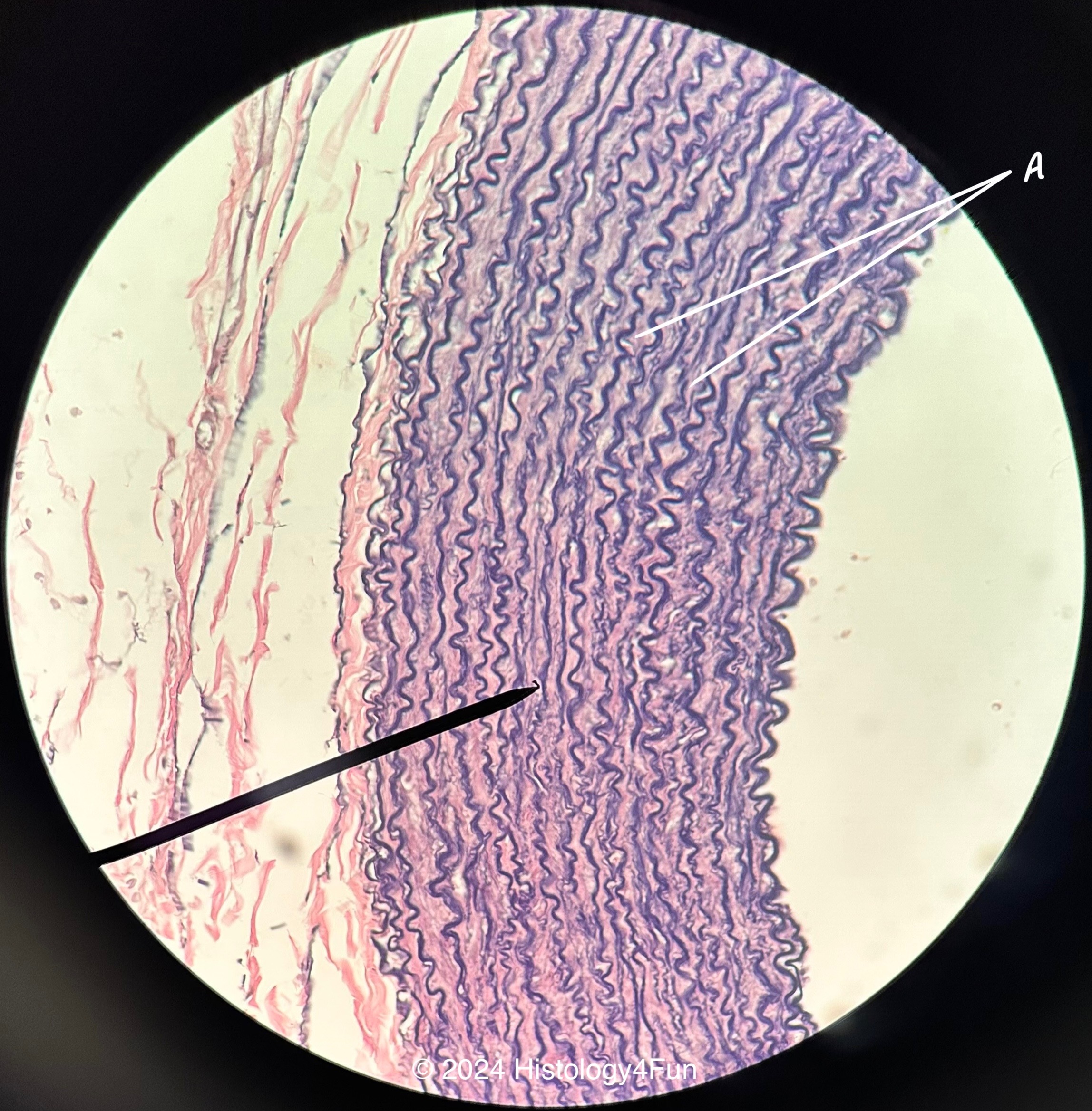 Elastic Tissue 