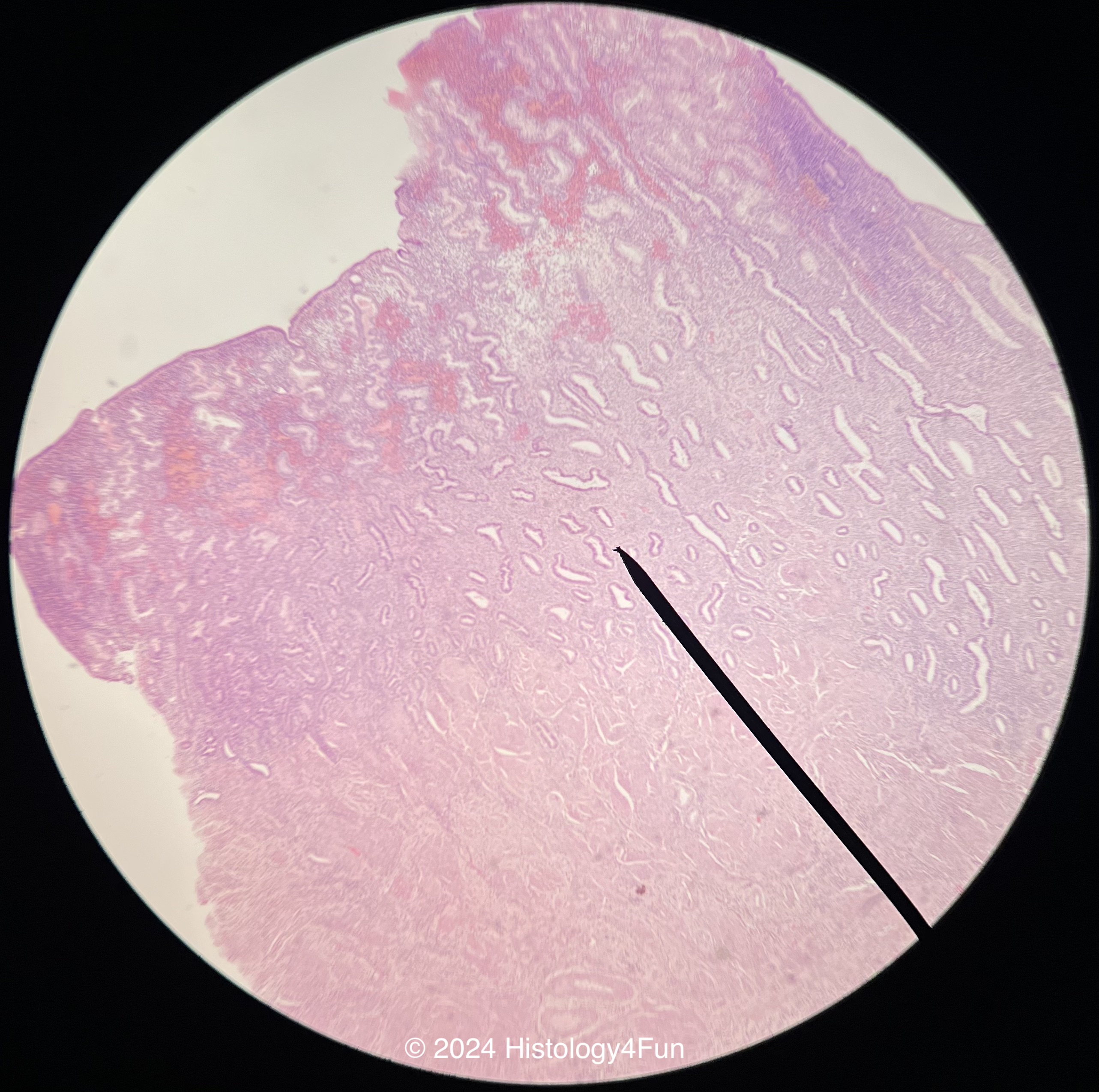 Endometrium - Proliferative Phase 
