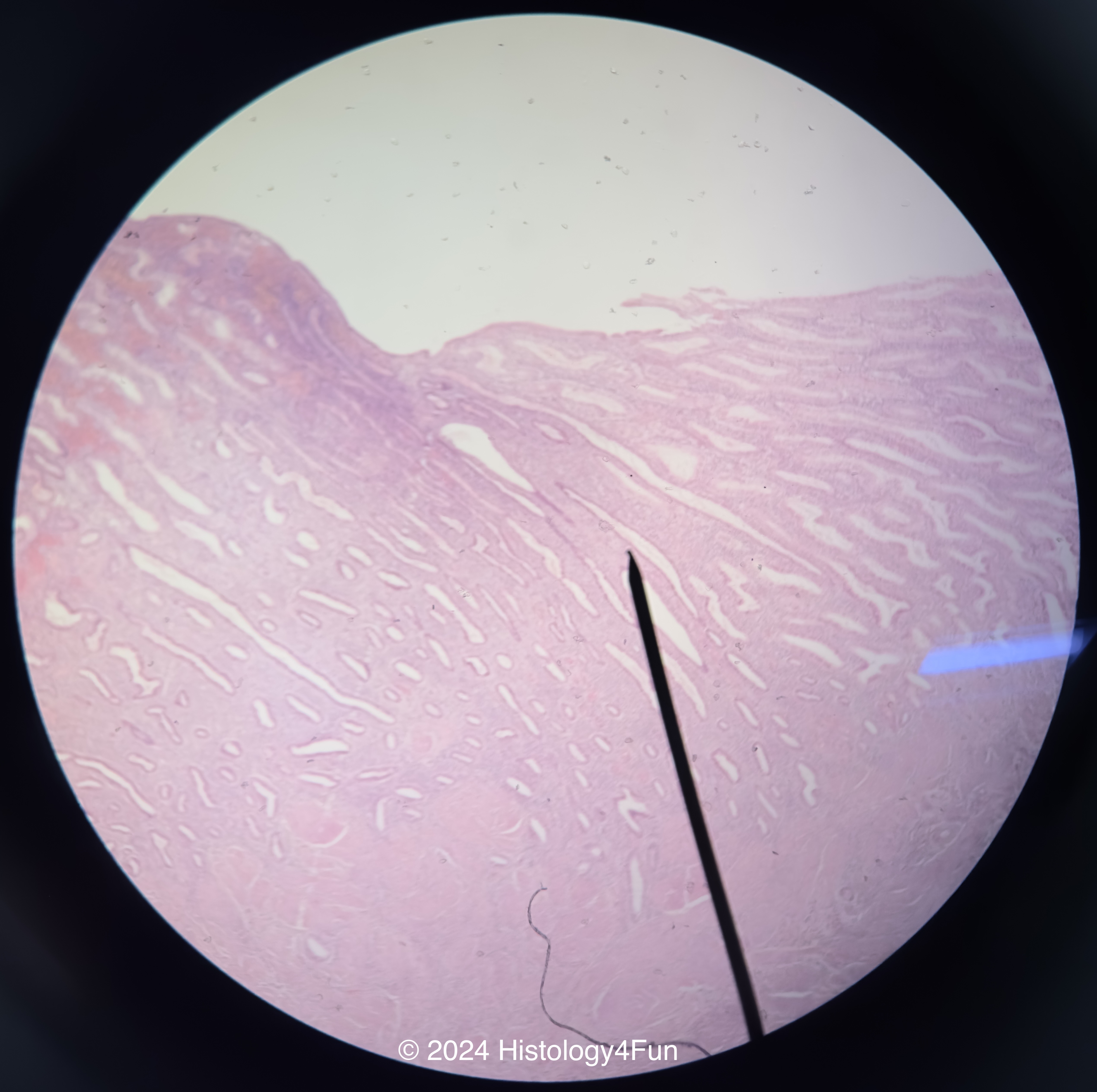 Endometrium - Secretory Phase 