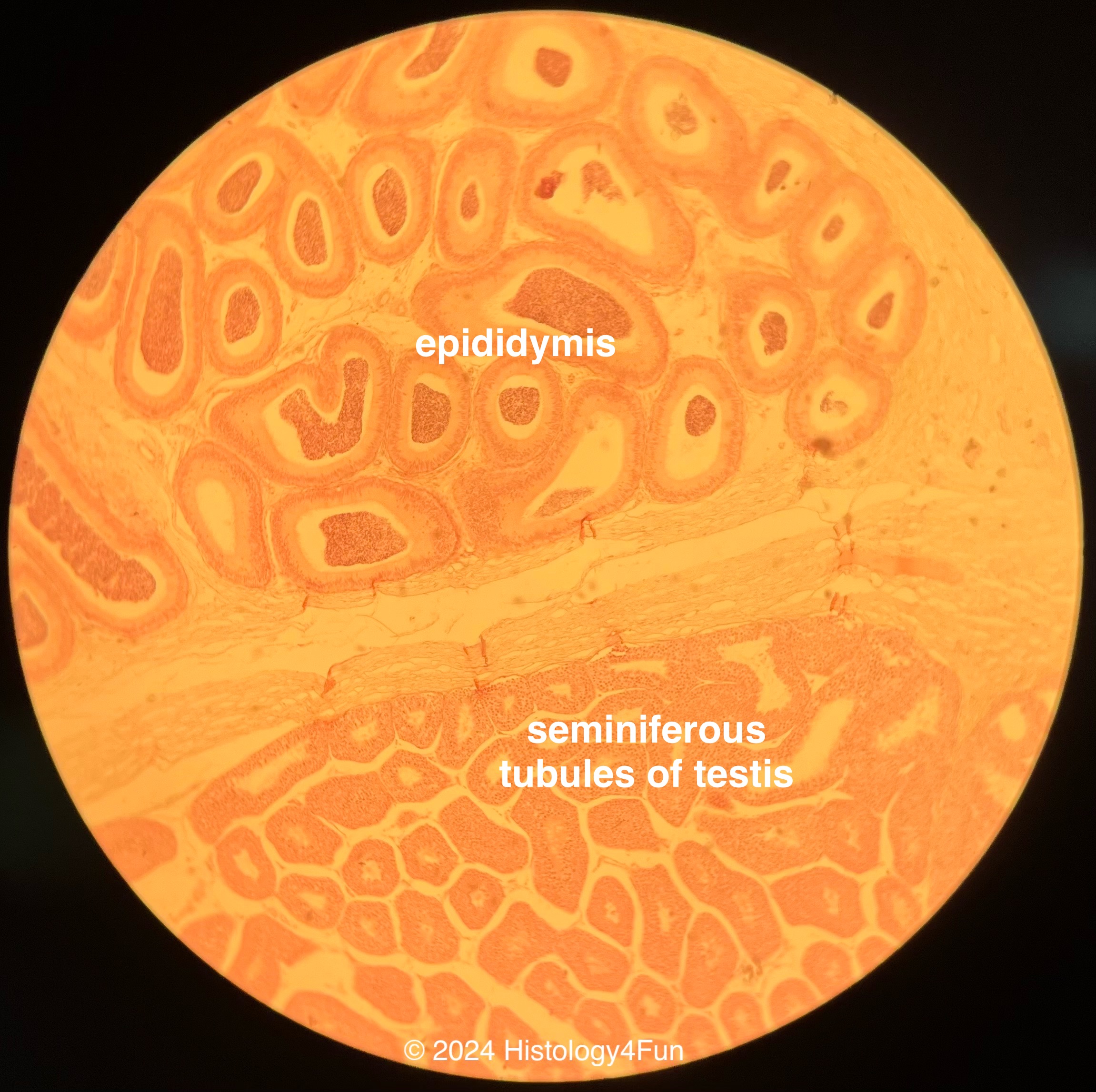 Epididymis vs Seminiferous Tubules 