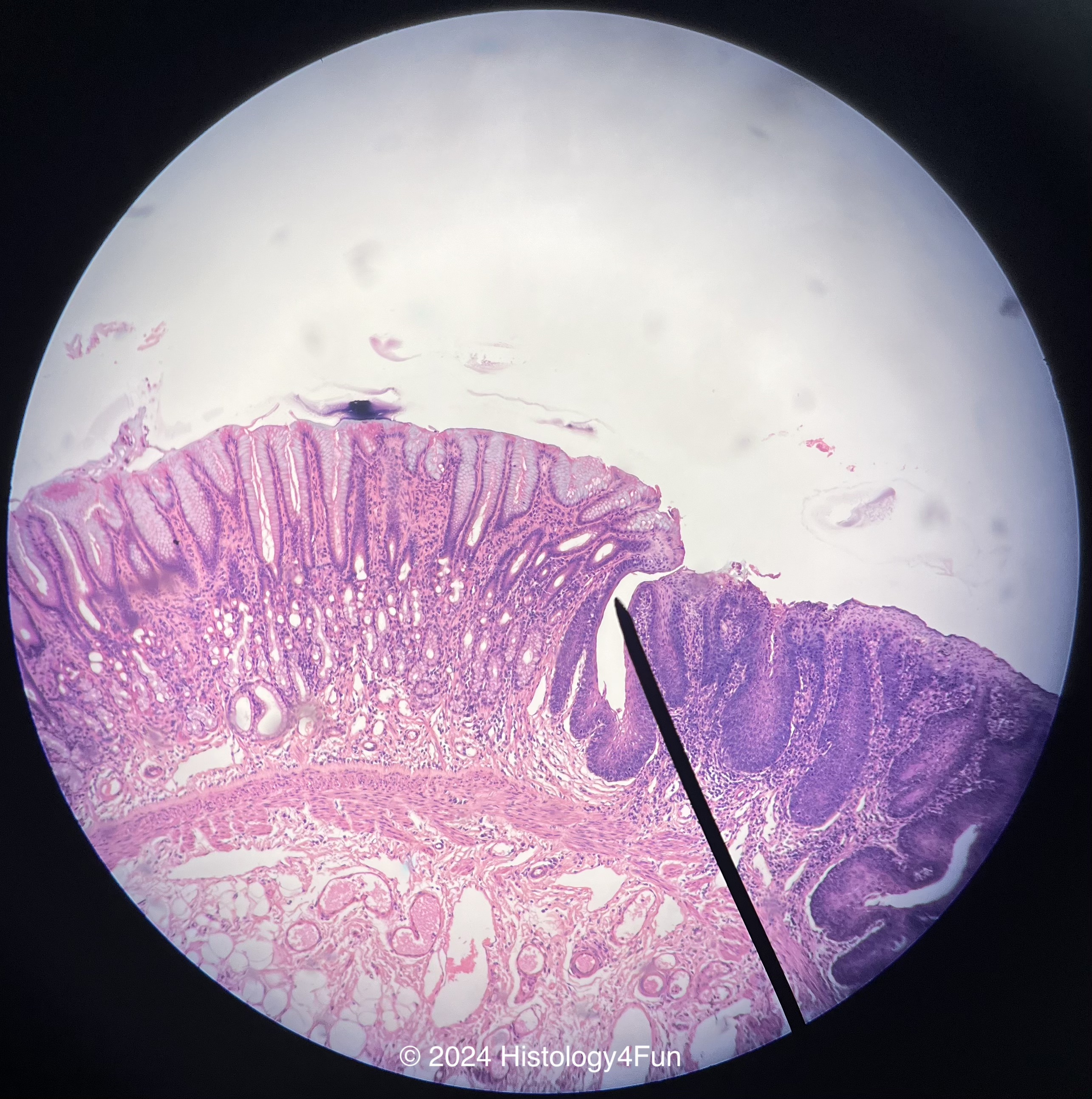 Esophagus and Stomach ***