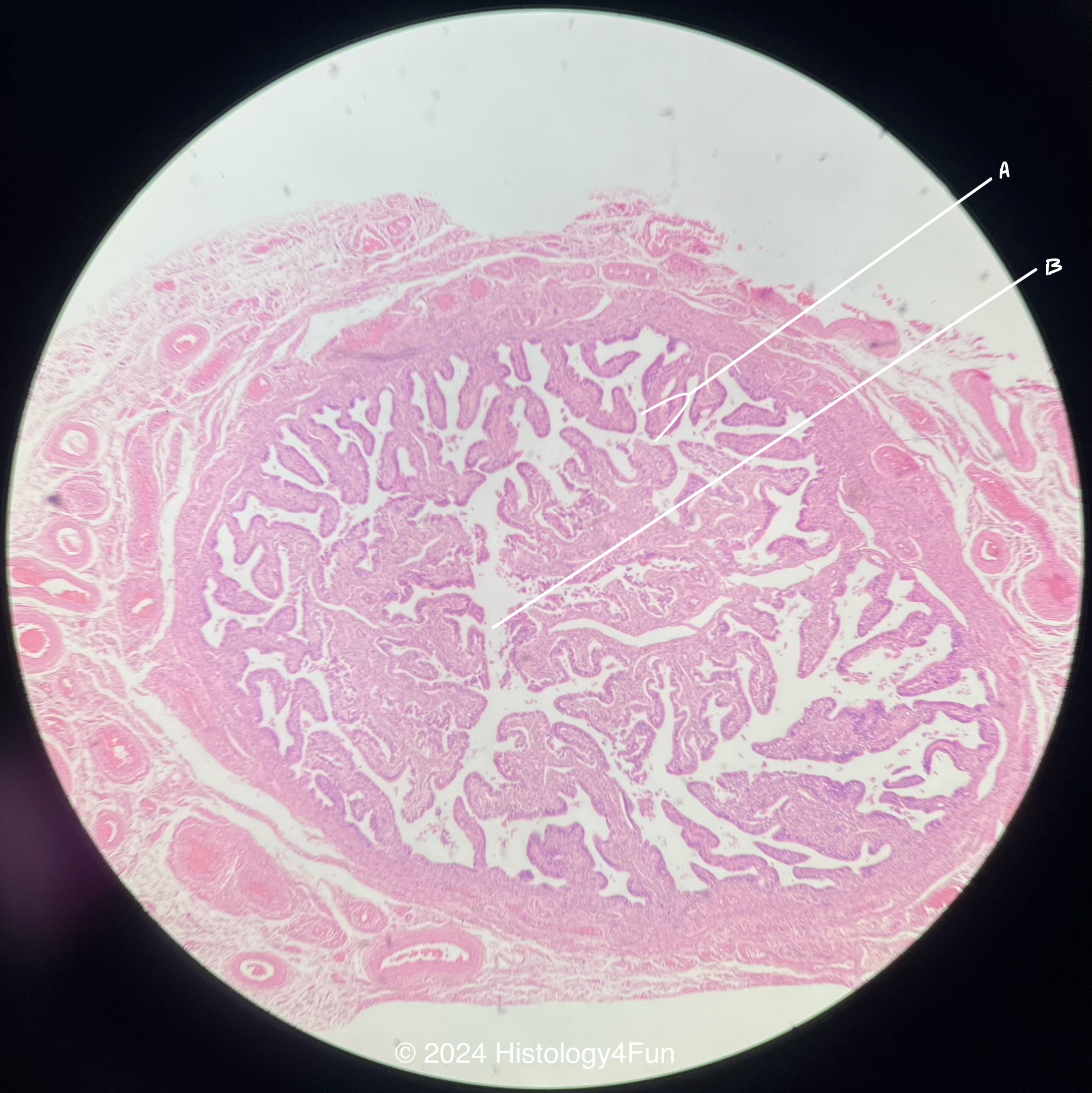 Fallopian Tube 