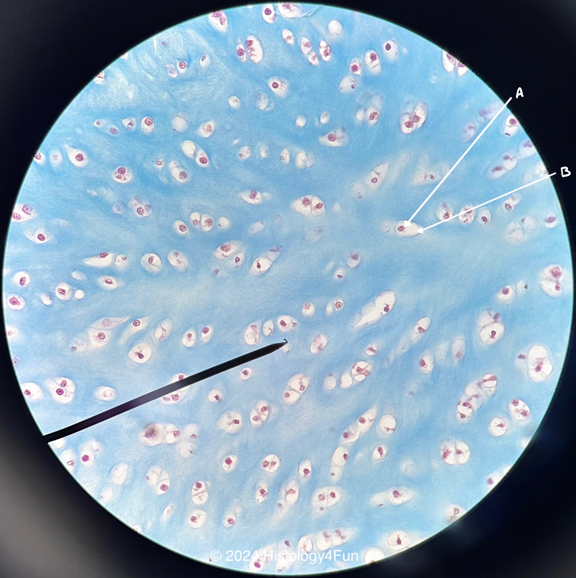 Fibrocartilage 