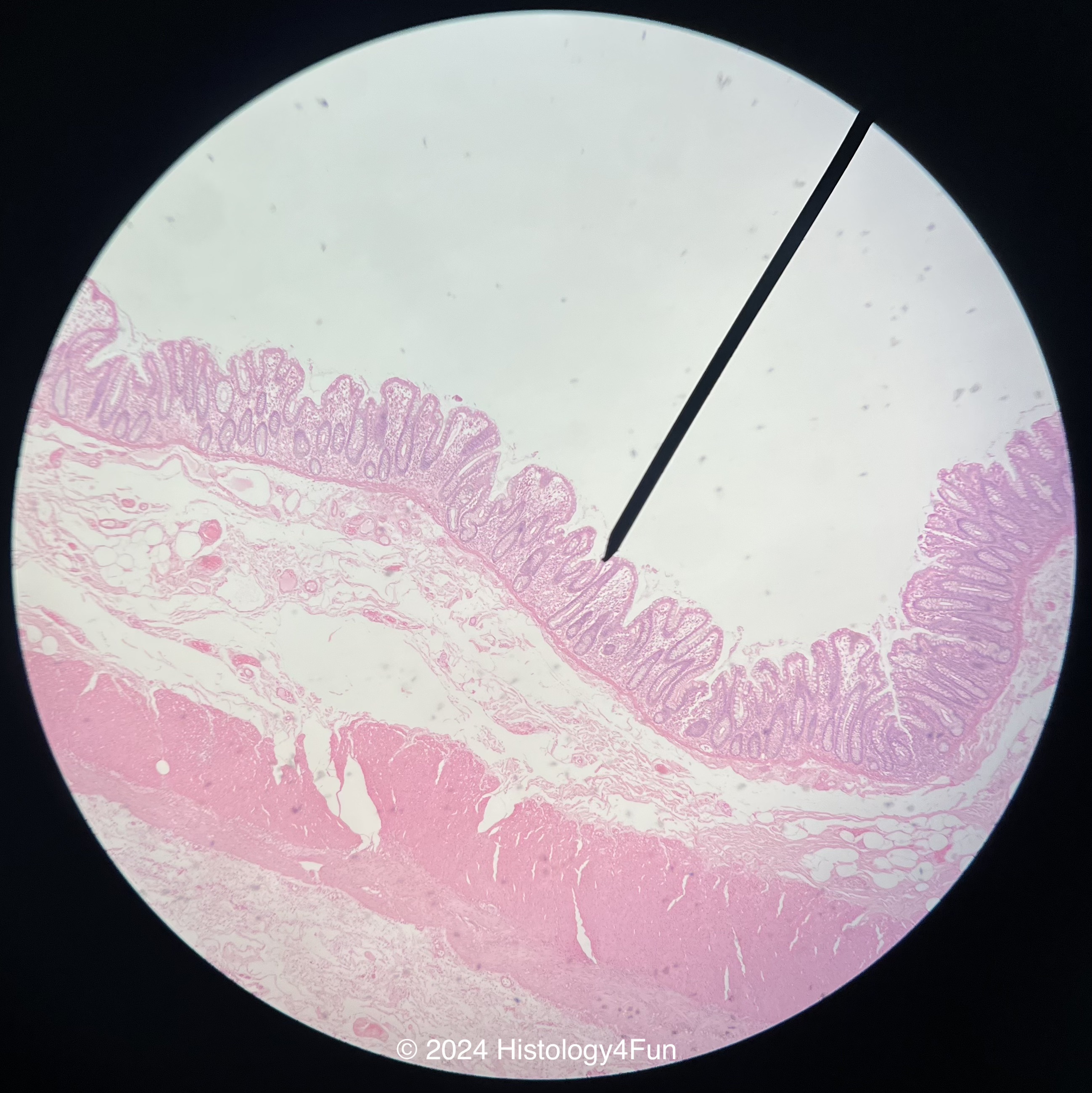 Goblet Cells - Colon 