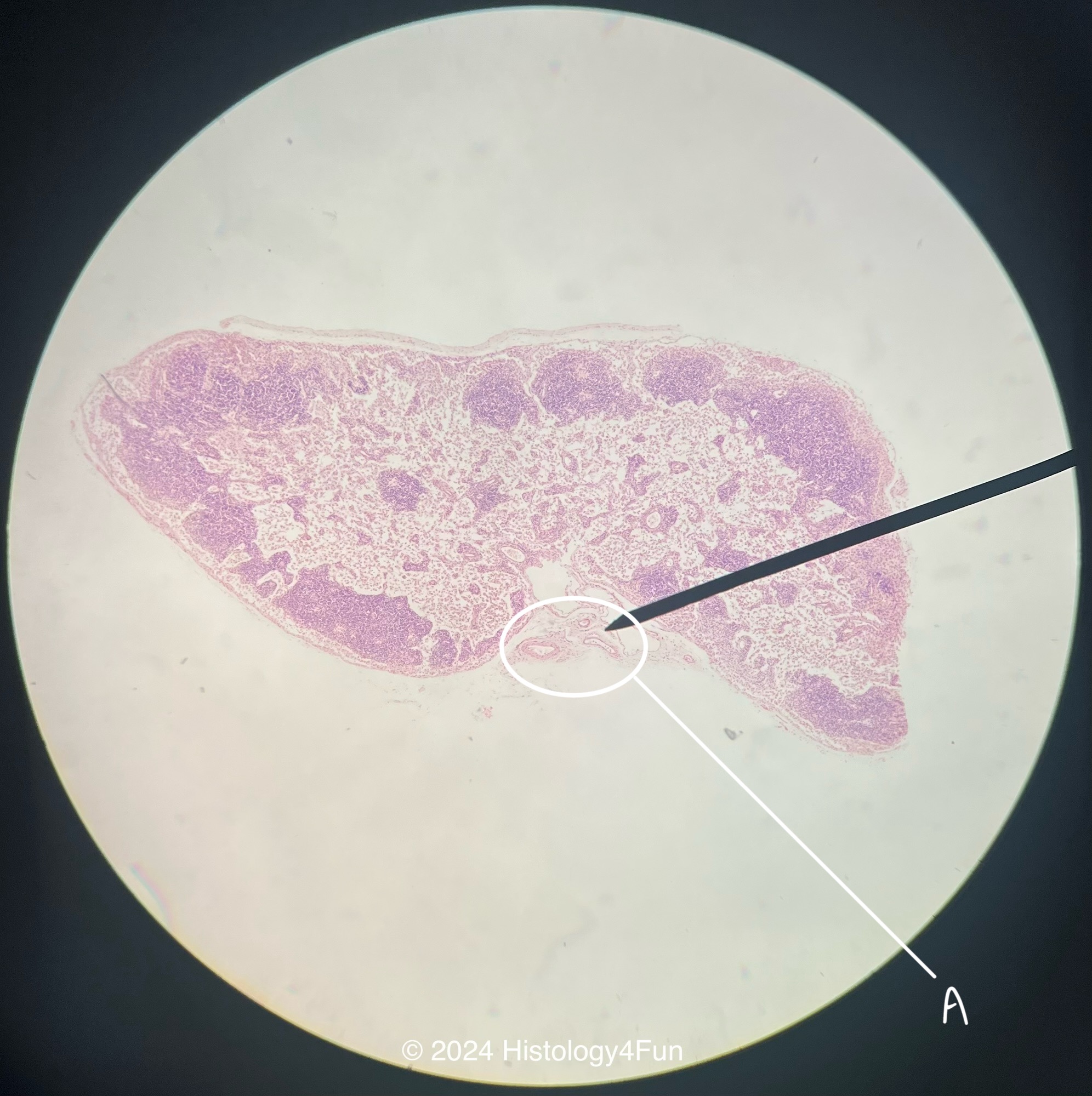 Lymph Node 20x