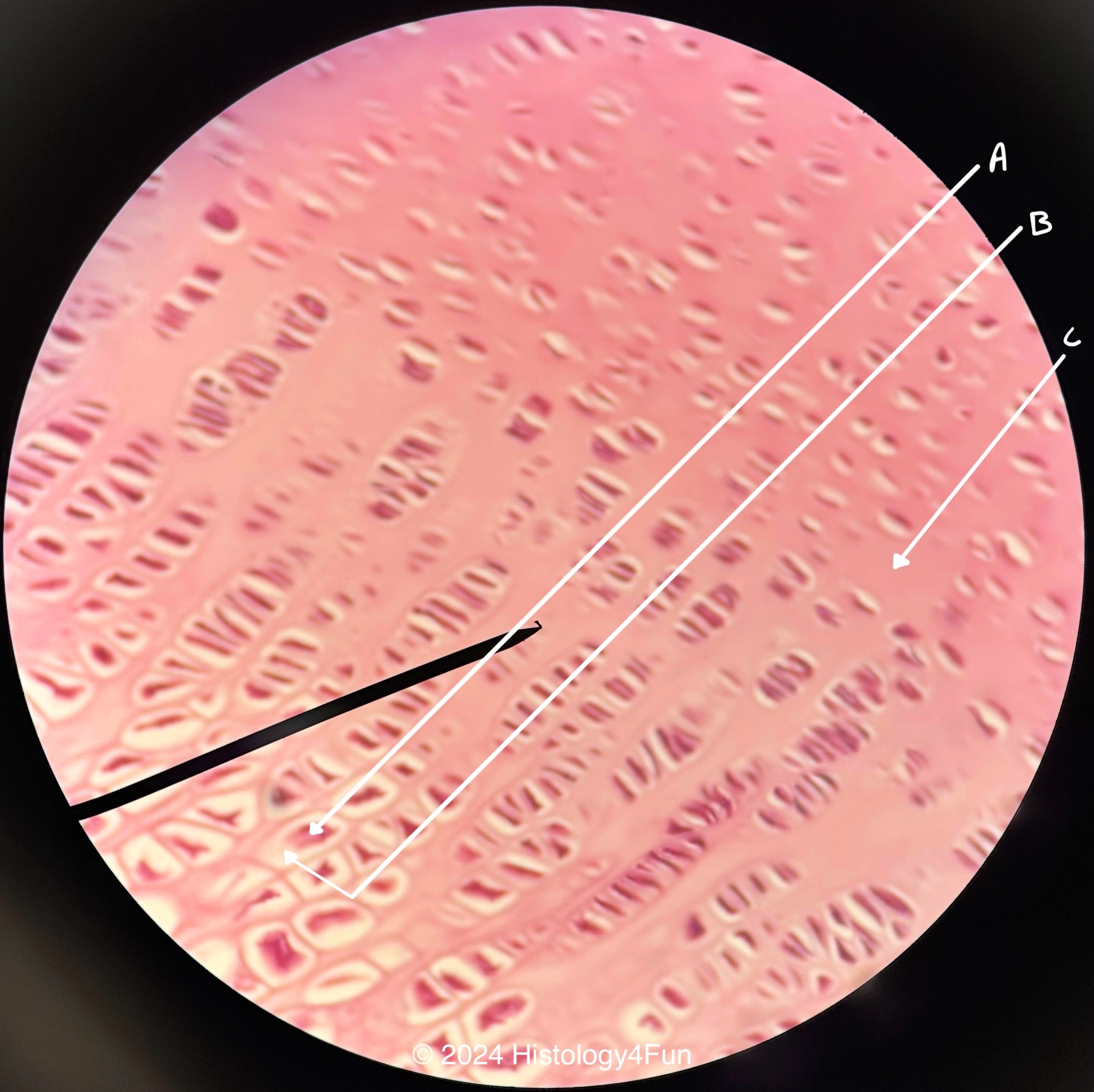 Hyaline Cartilage 