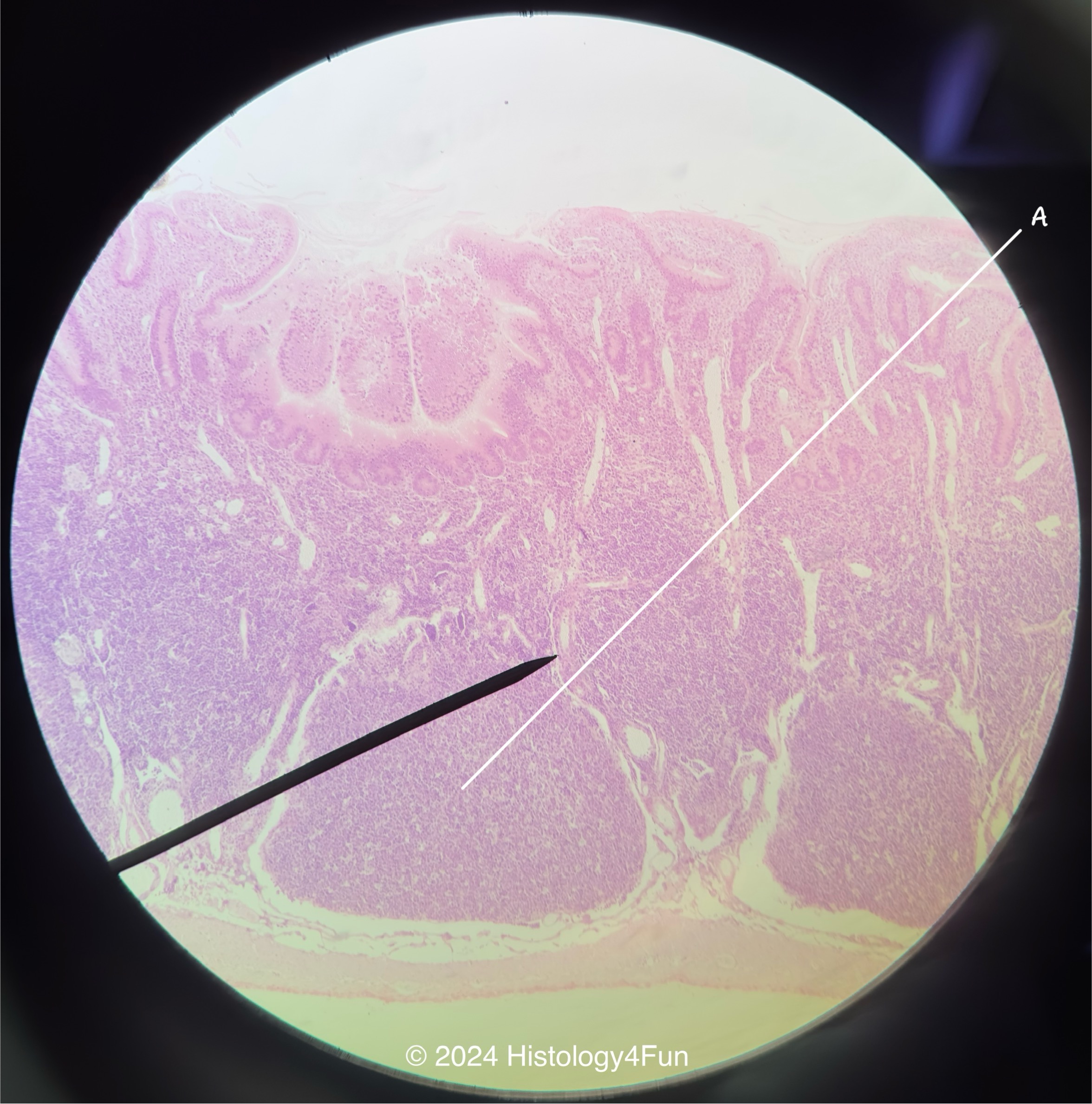Small Intestines - Illeum 