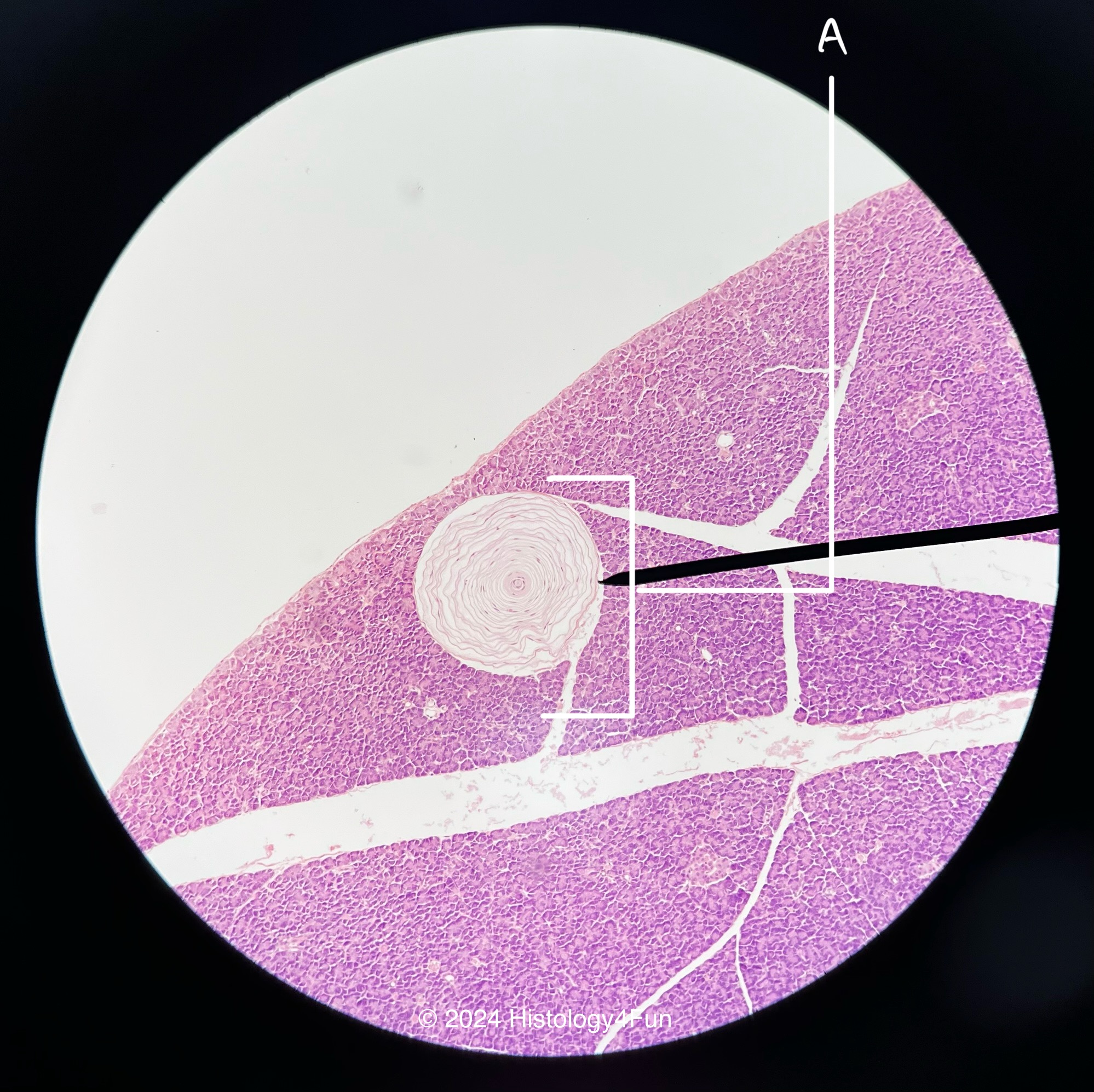 Pacinian Corpuscle 