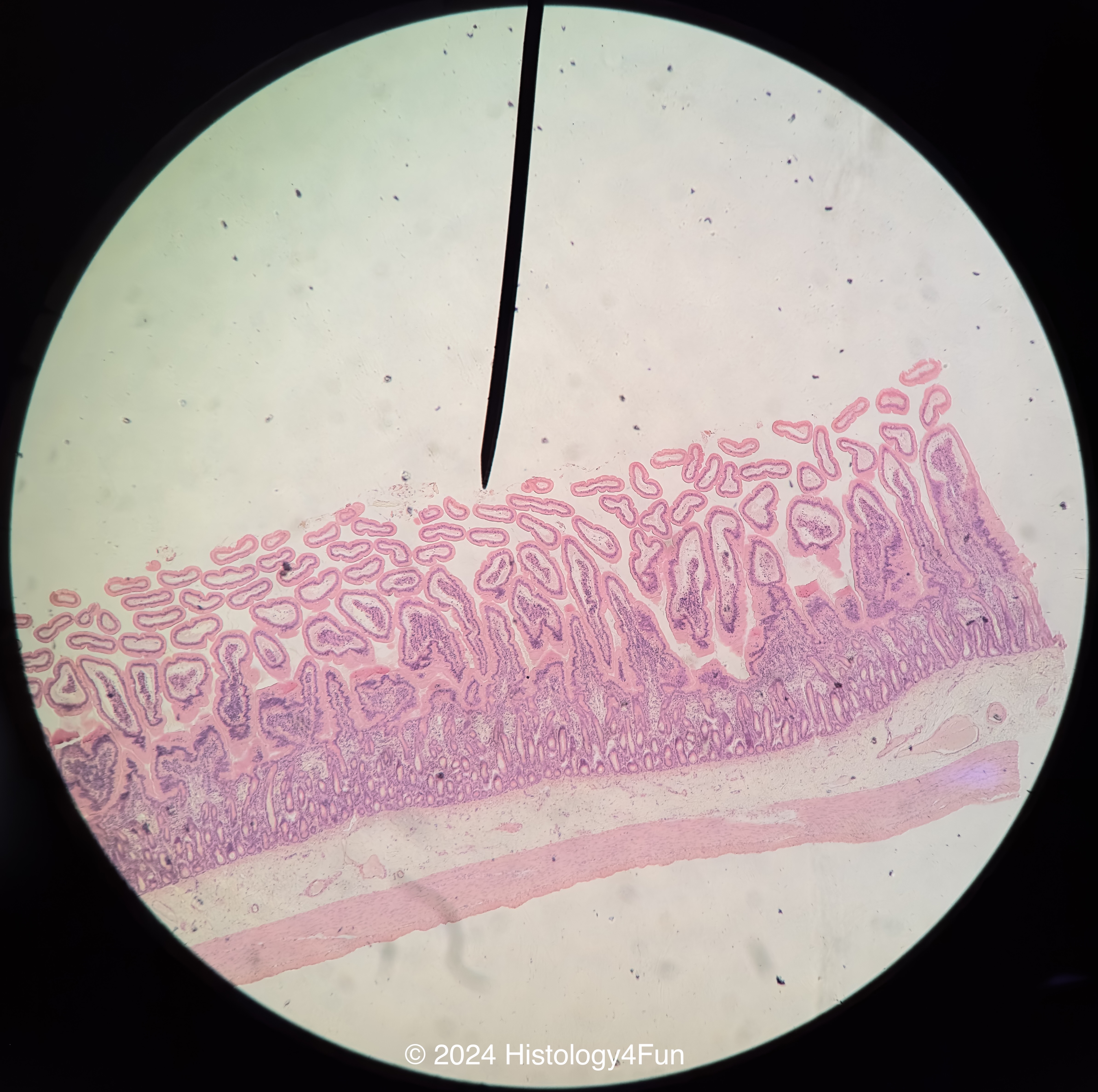 Small Intestines - Jejunum 