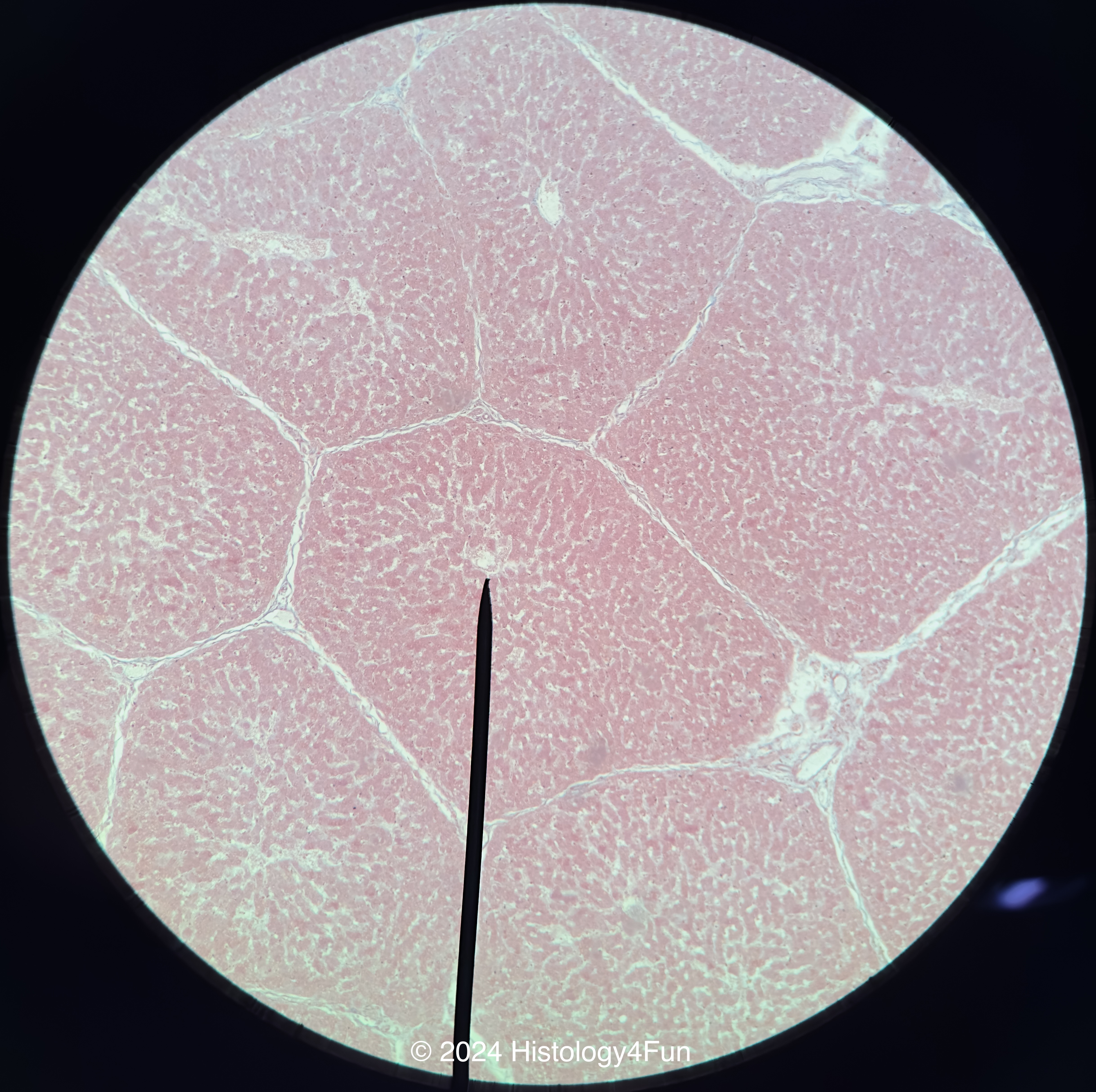 Liver 