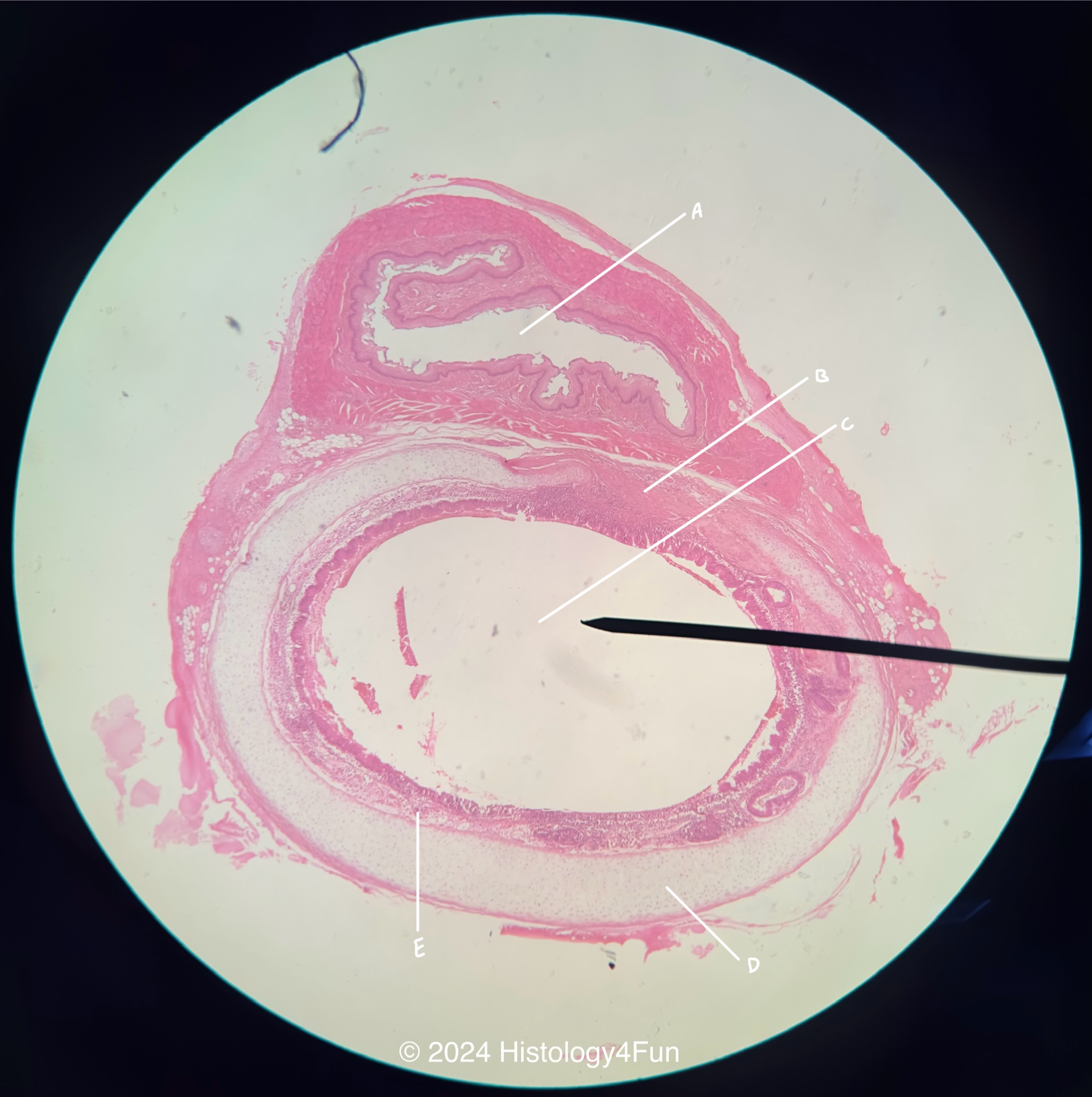 Trachea + Esophagus 