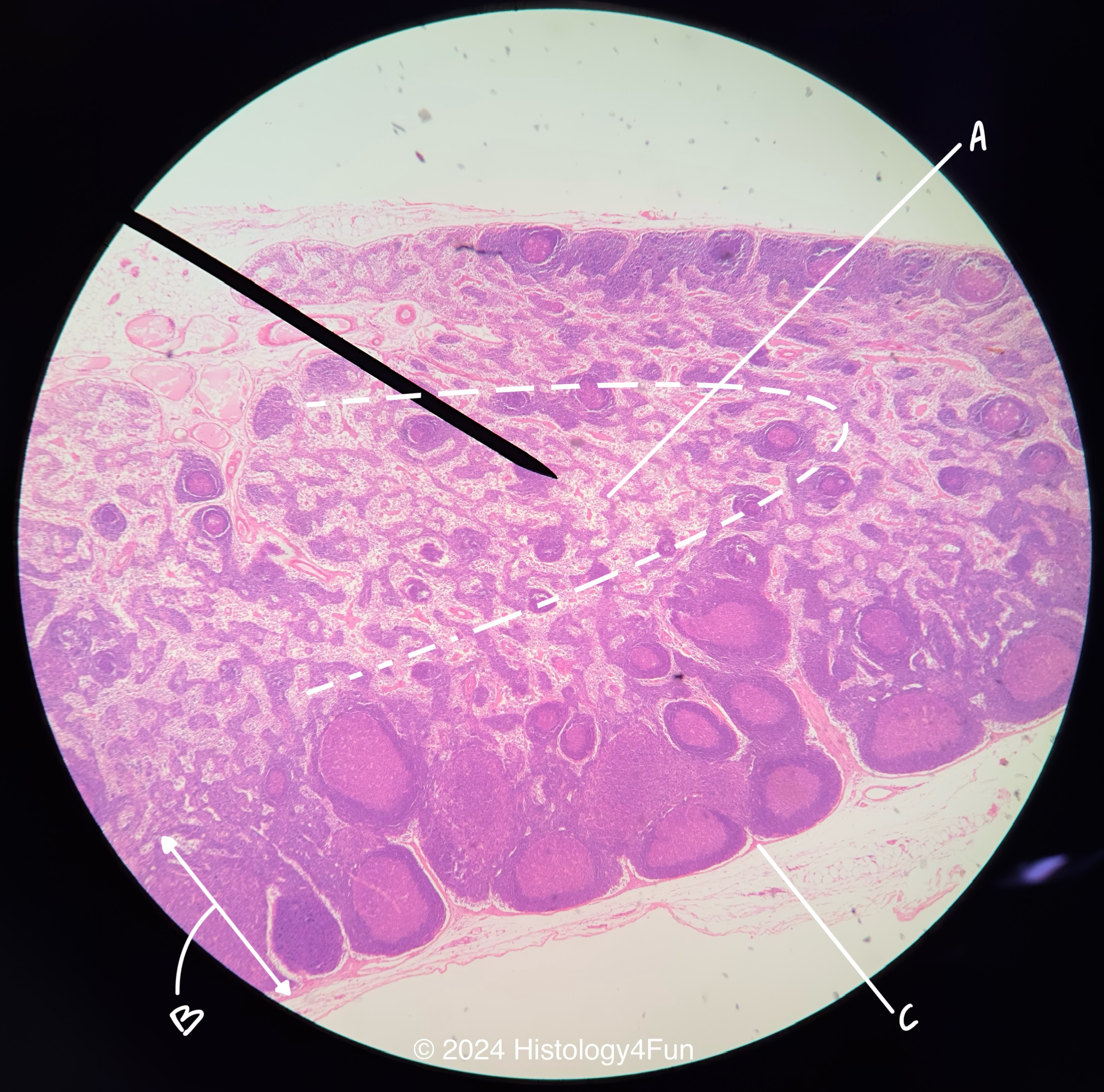 Lymph Node 40x