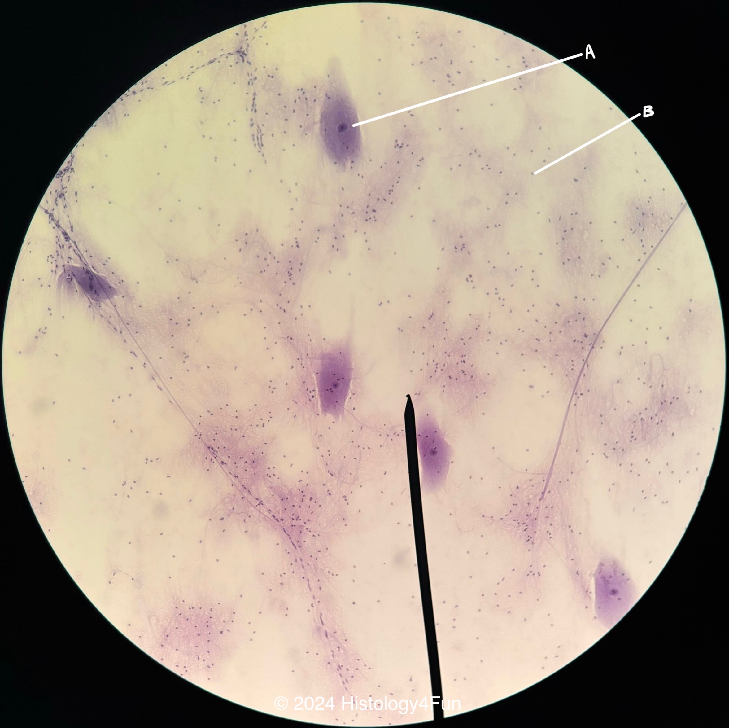 Motor Neurons in the Spinal Cord - Smeared