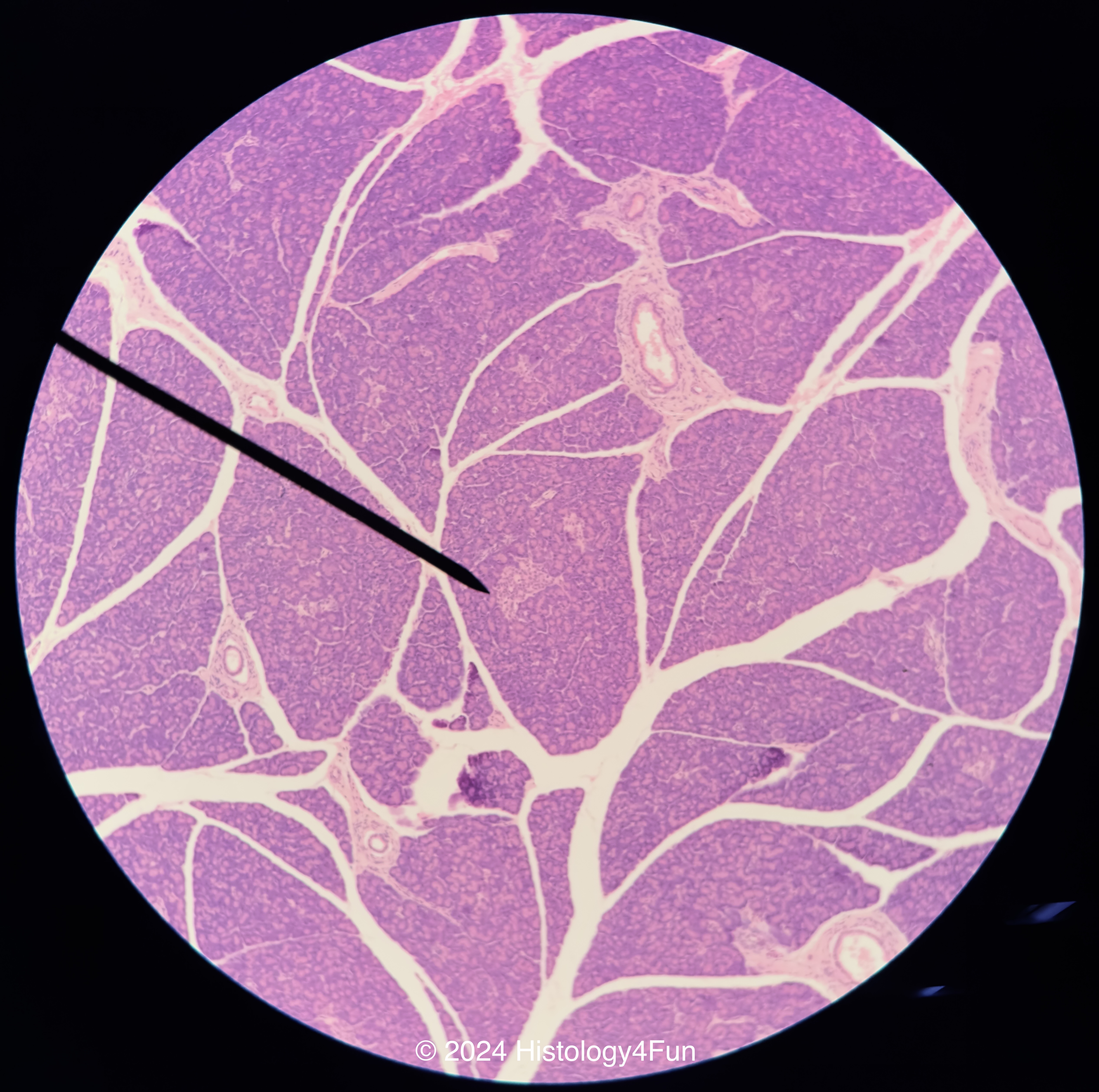 Pancreas 