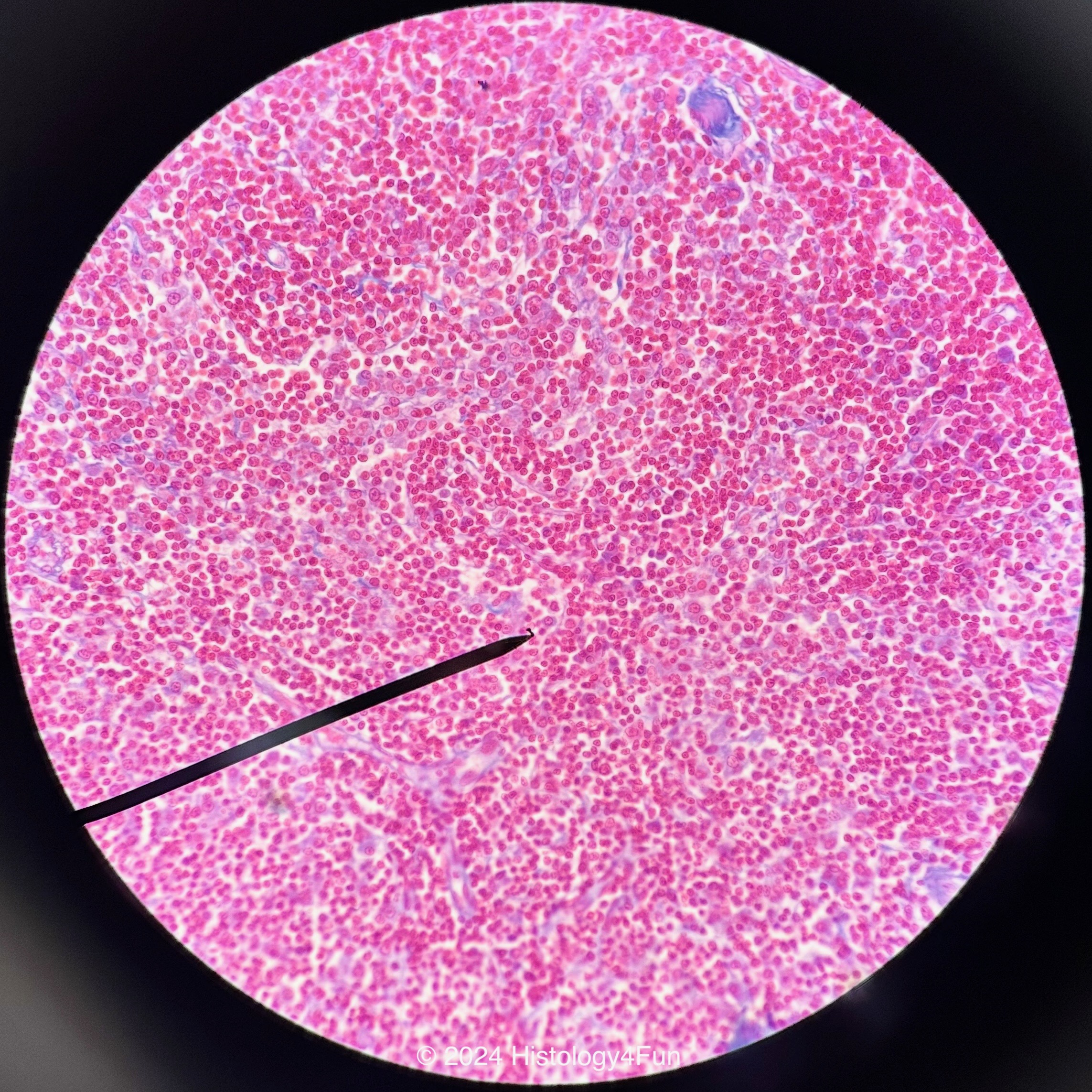 Reticular Tissue 