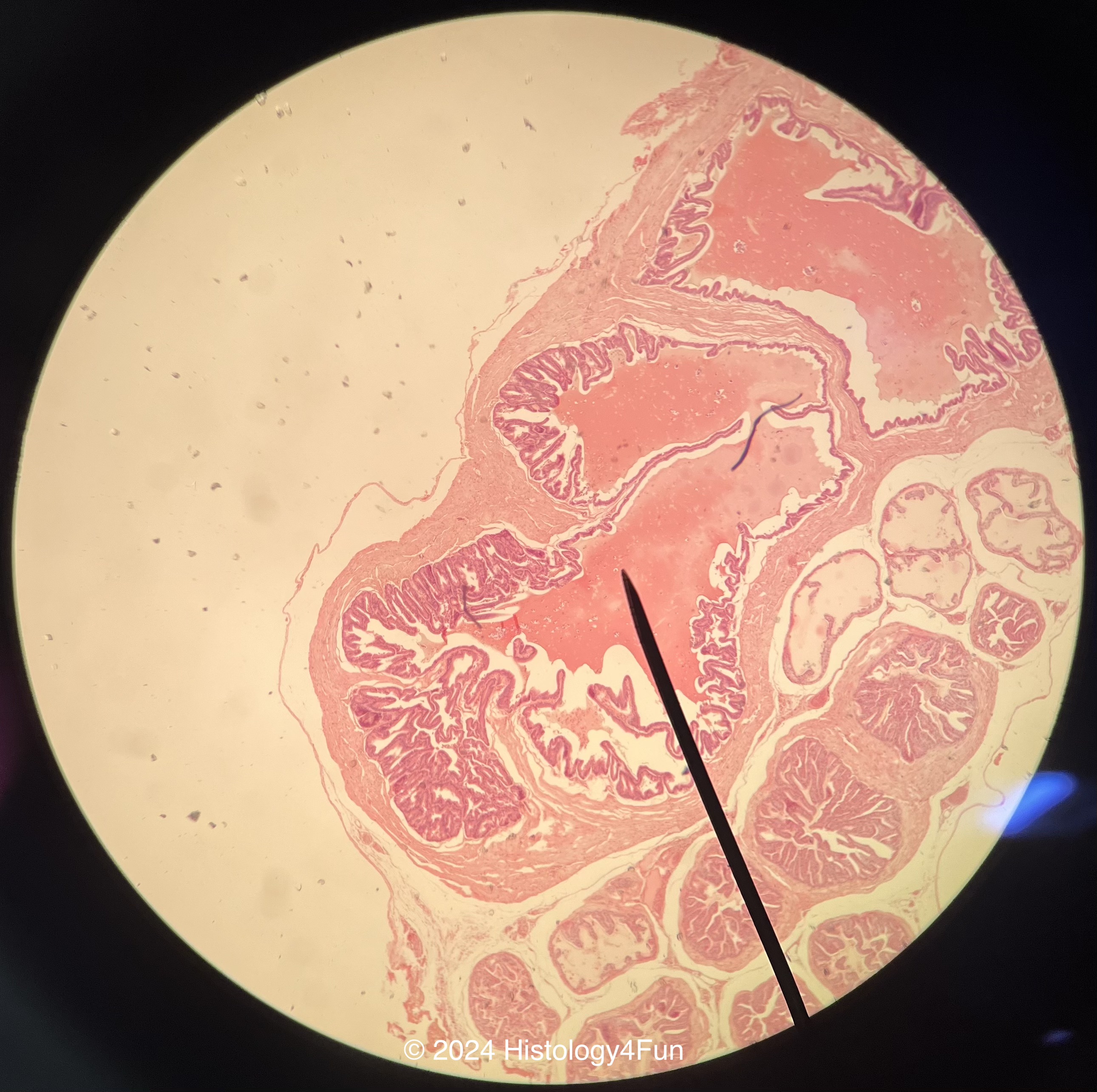 Seminal Vesicles