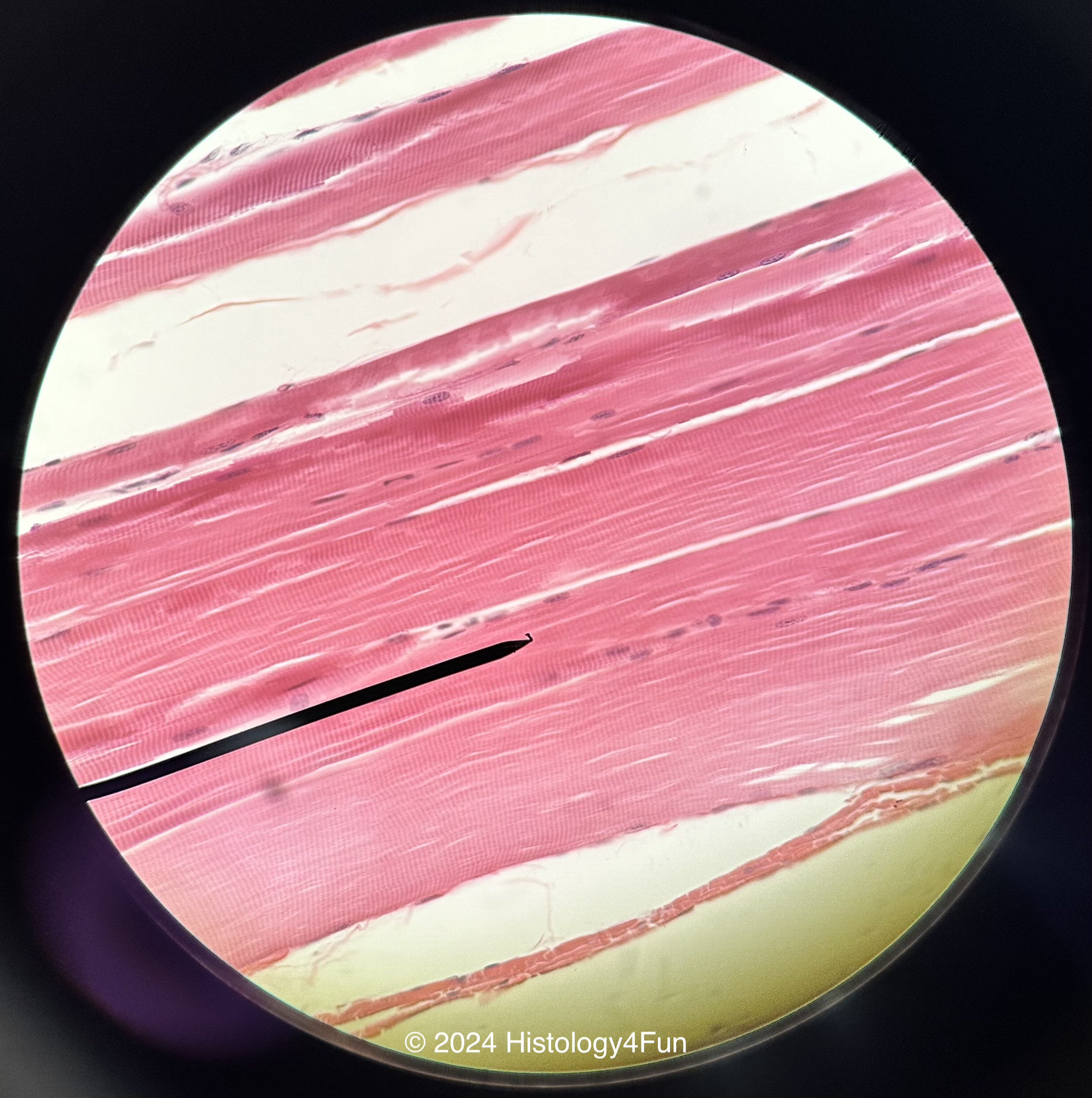 Skeletal Muscle