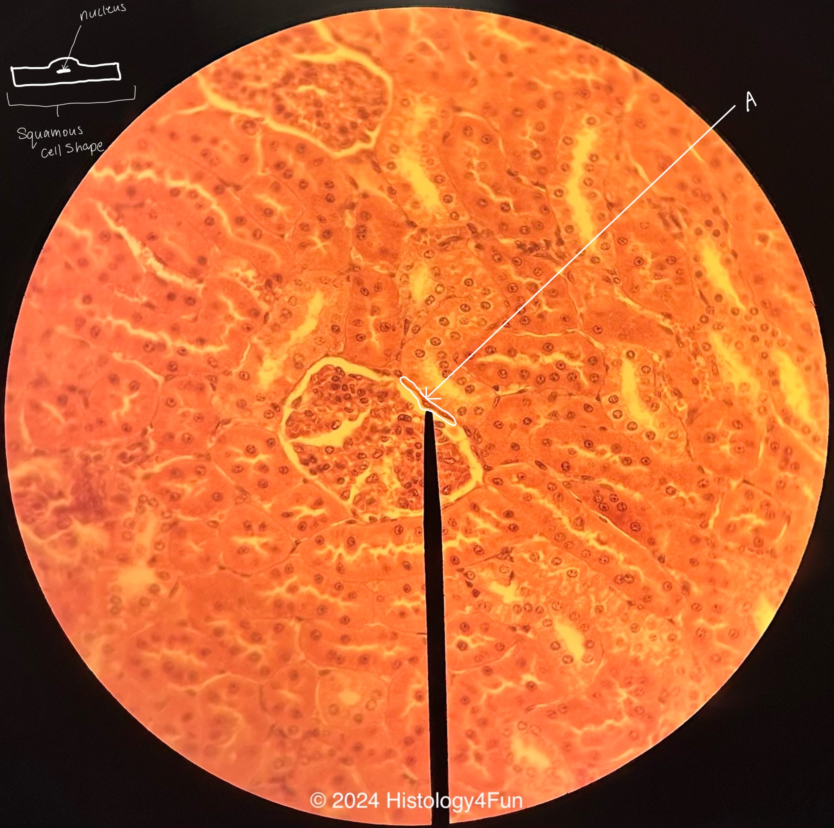 Simple Squamous Epithelium