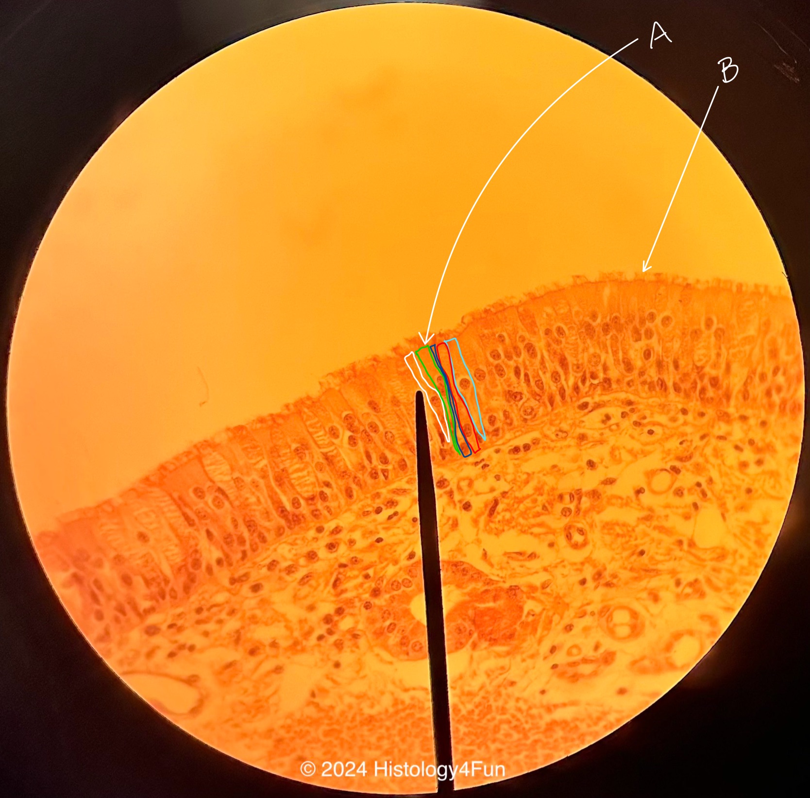 Pseudo-stratified Ciliated Columnar Epithelium