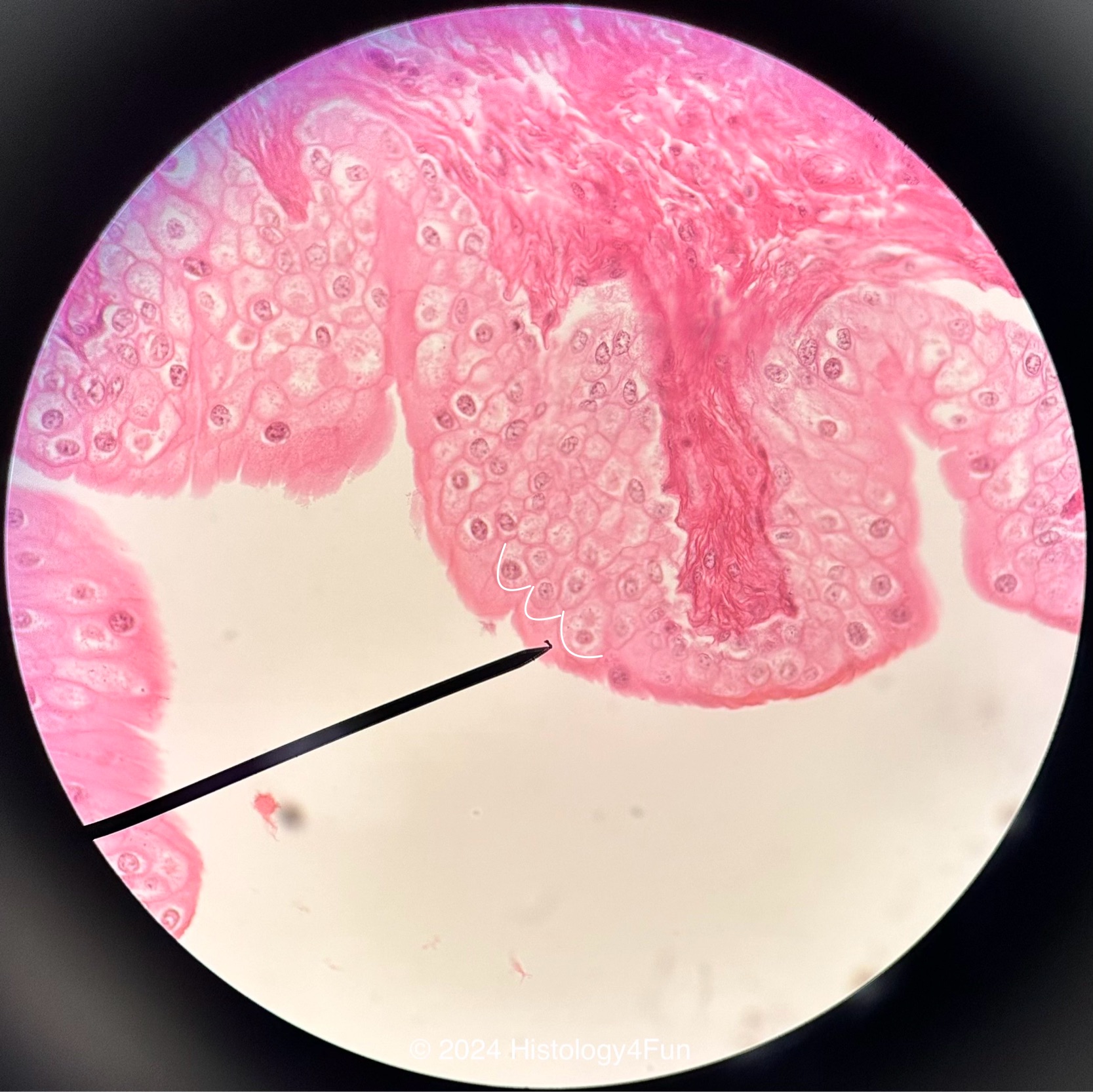 Transitional Epithelium - Relaxed