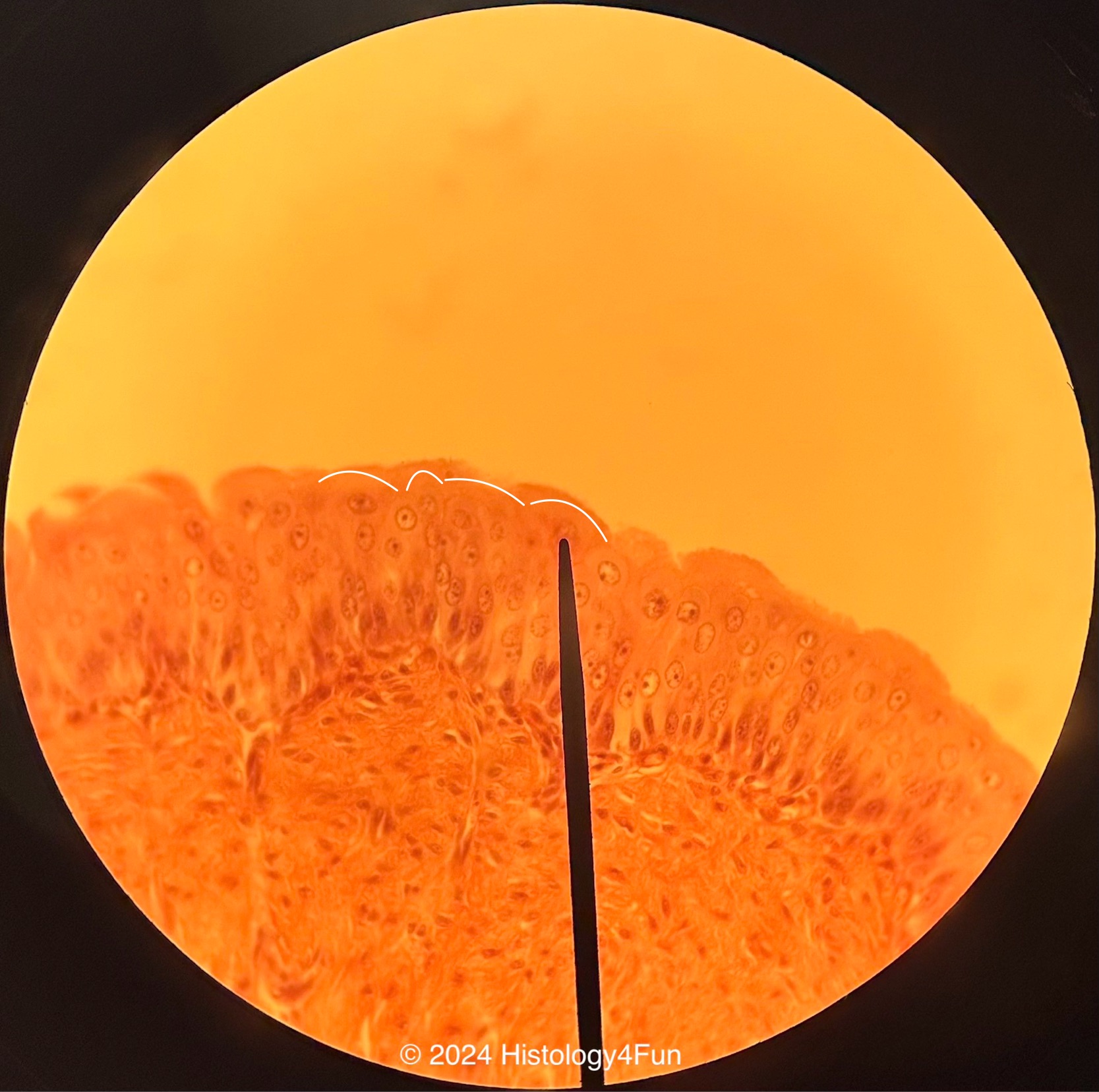 Transitional Epithelium - Distended 