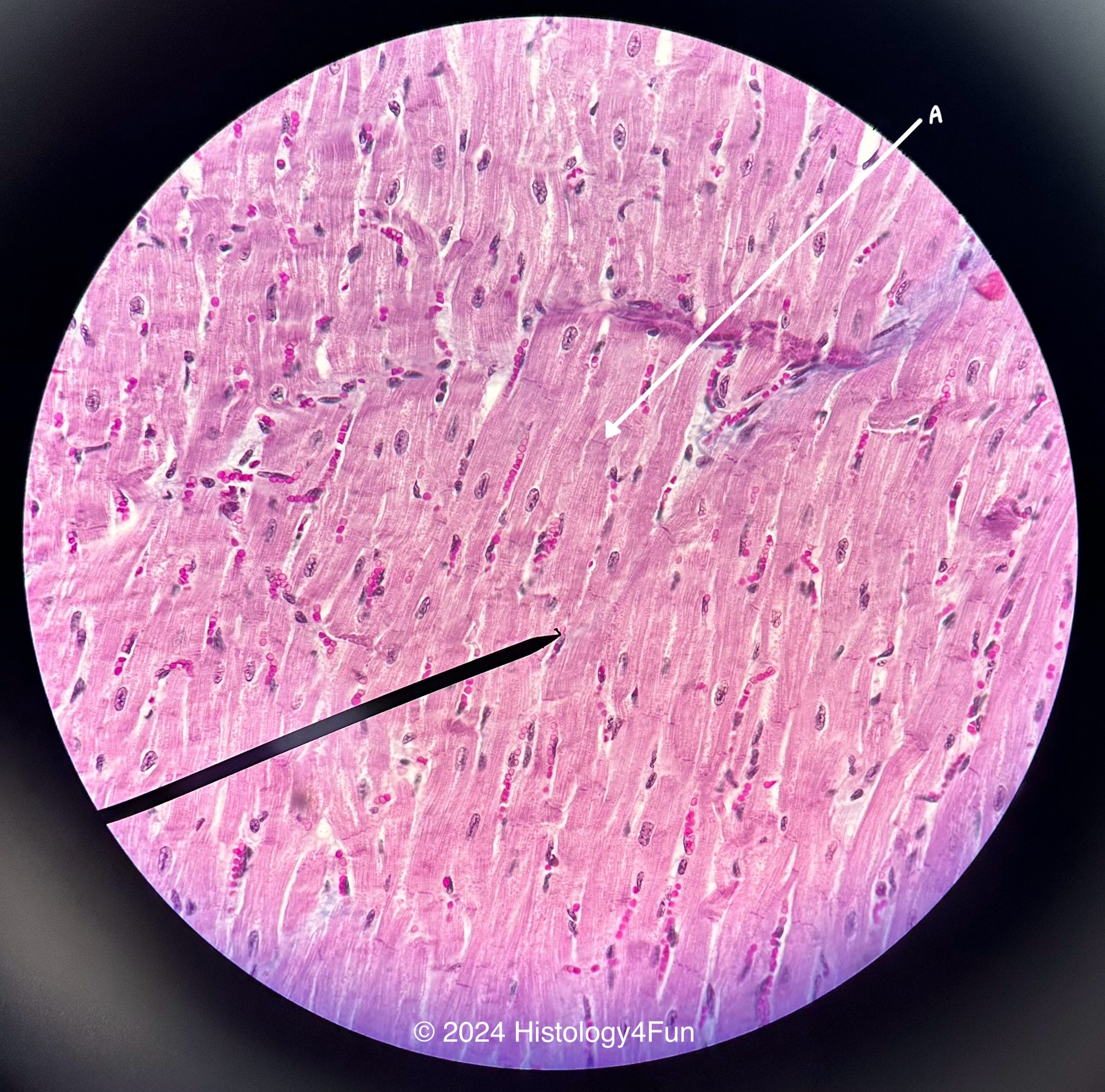 Cardiac Muscle 