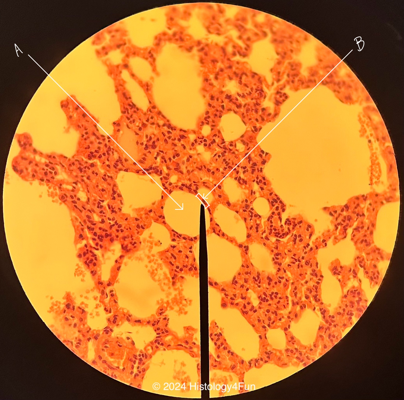 Simple Squamous Epithelium 