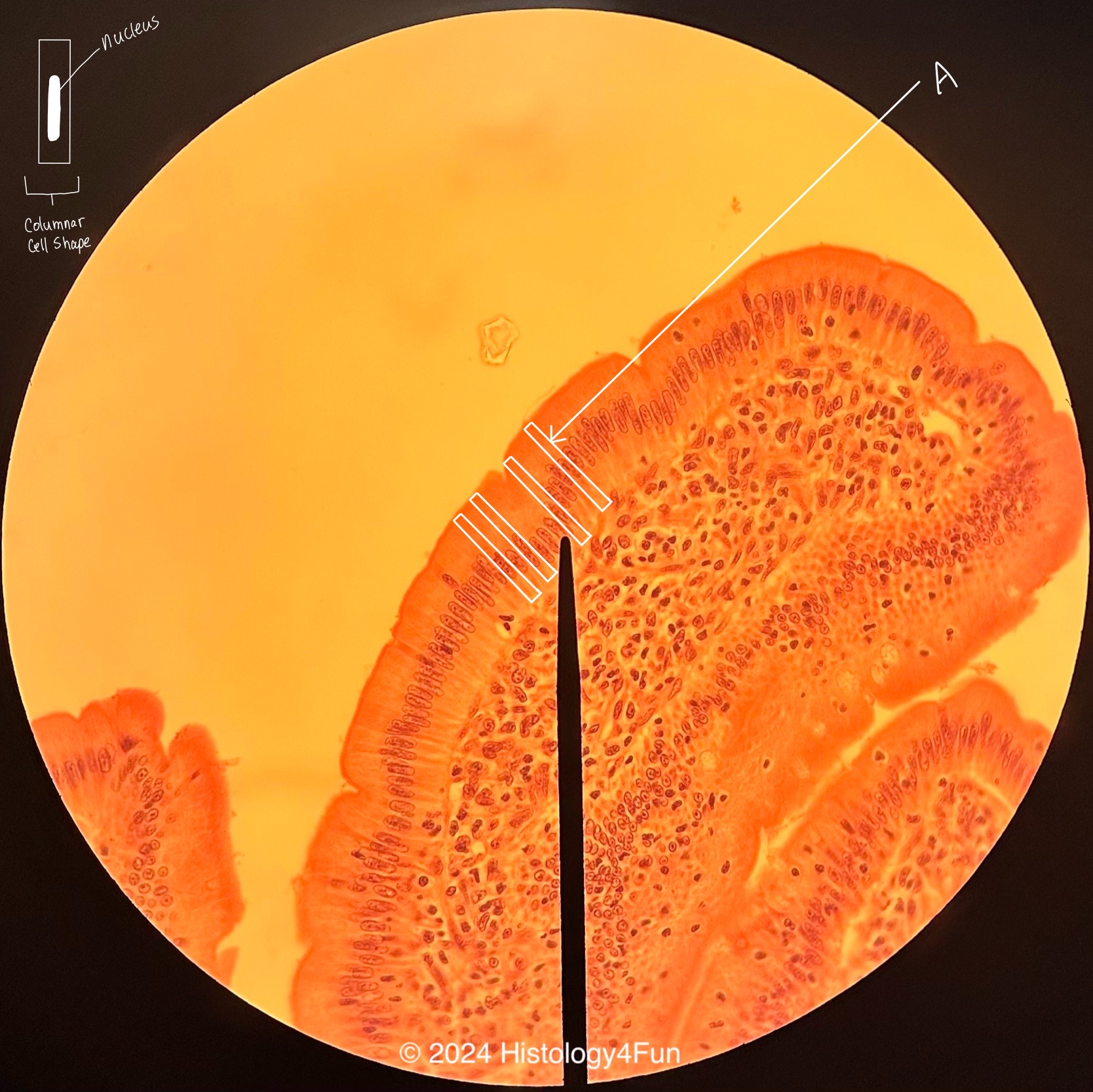 Simple Columnar Epithelium