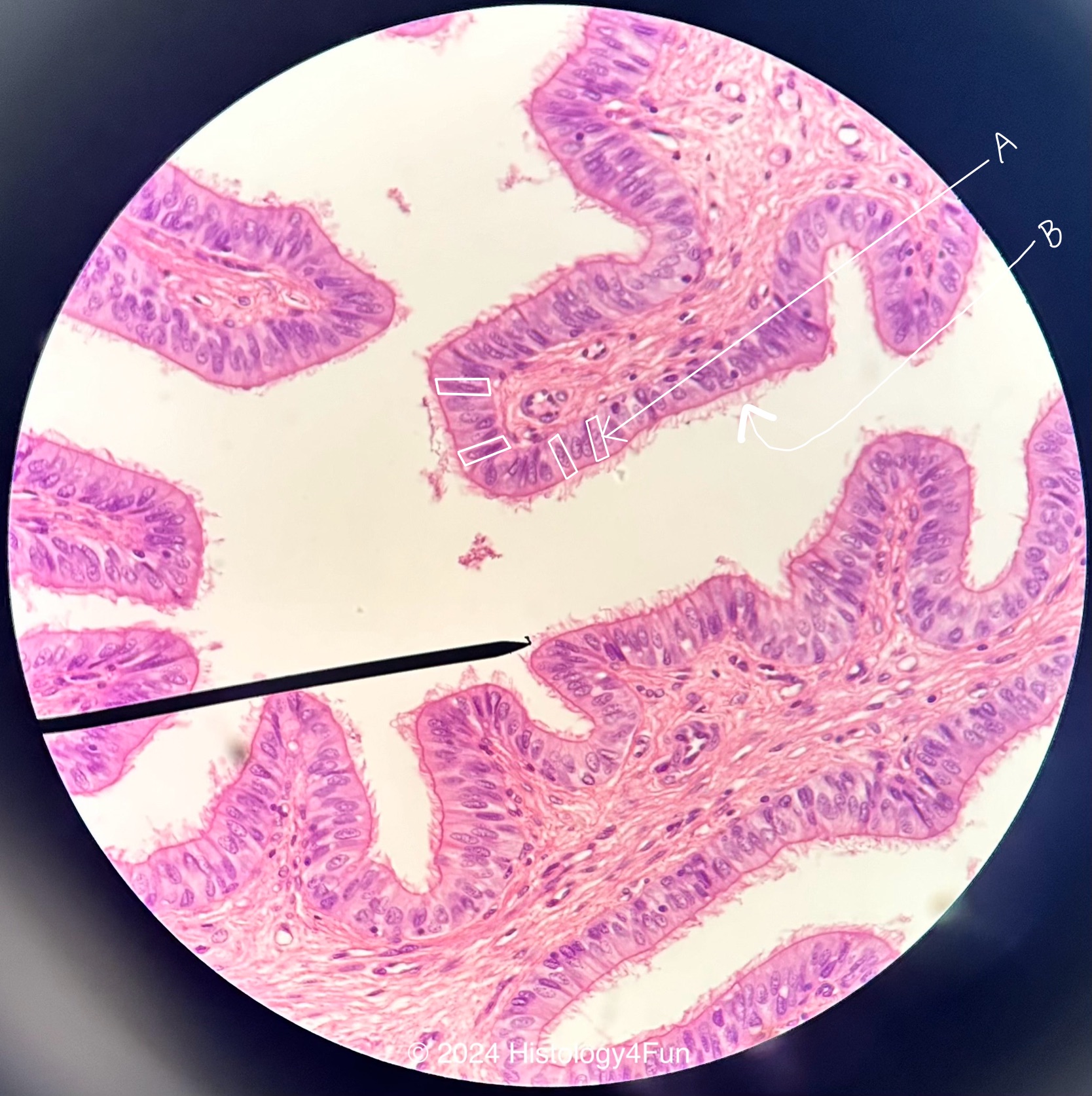 Ciliated Columnar Epithelium