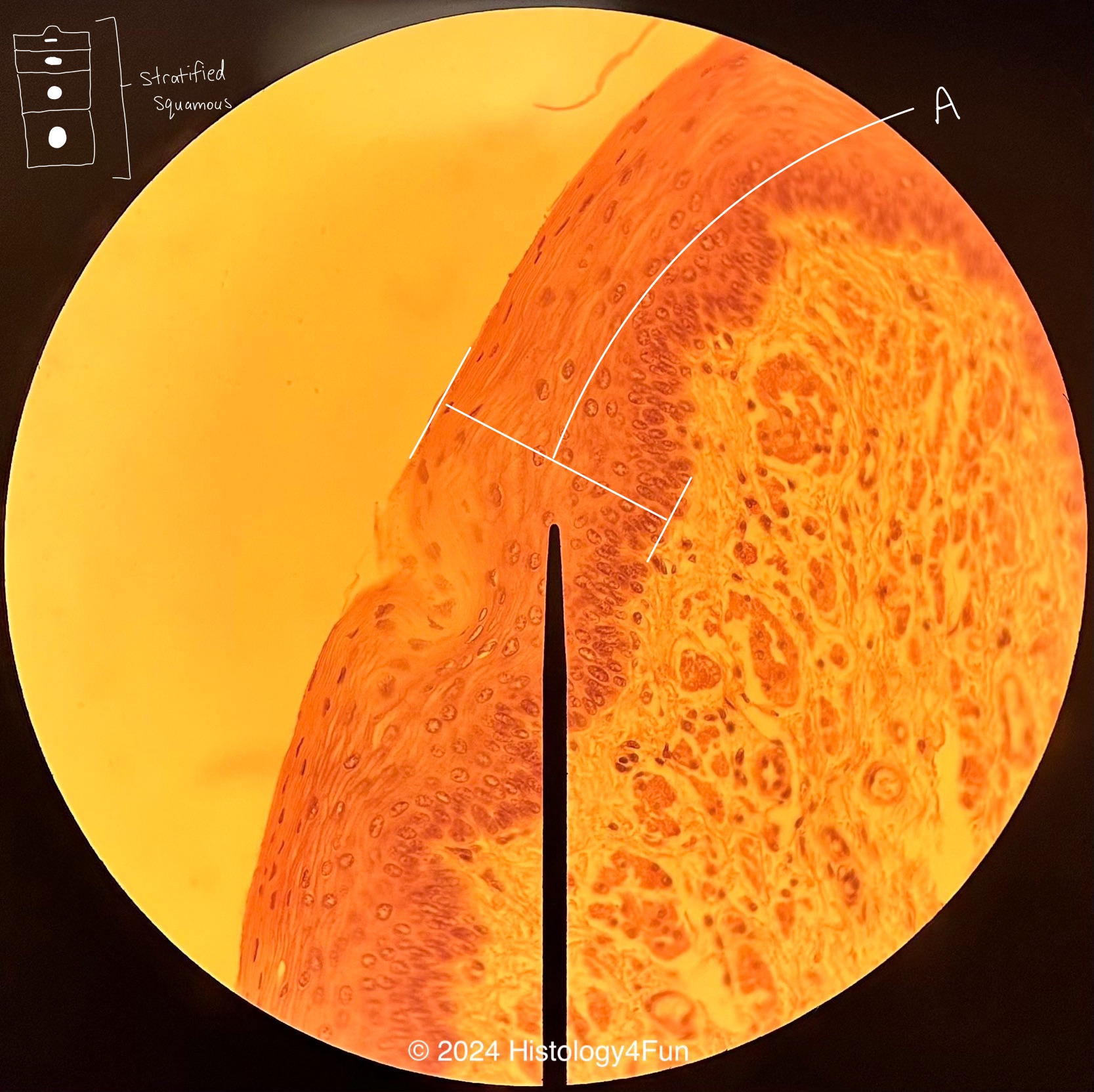 Stratified Squamous Epithelium - Non-Keratinizing 