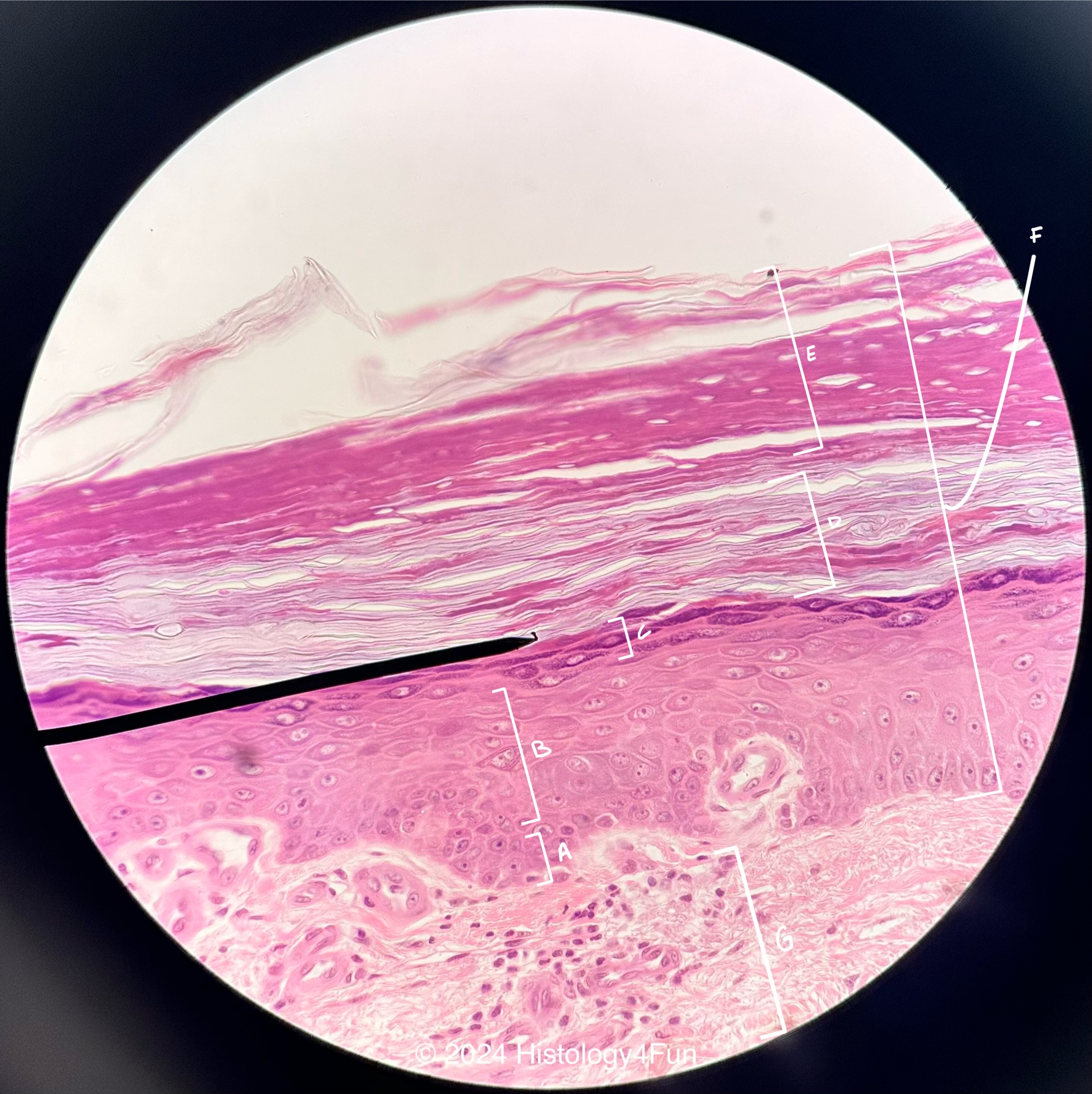 Stratified Squamous Epithelium - Keratinizing