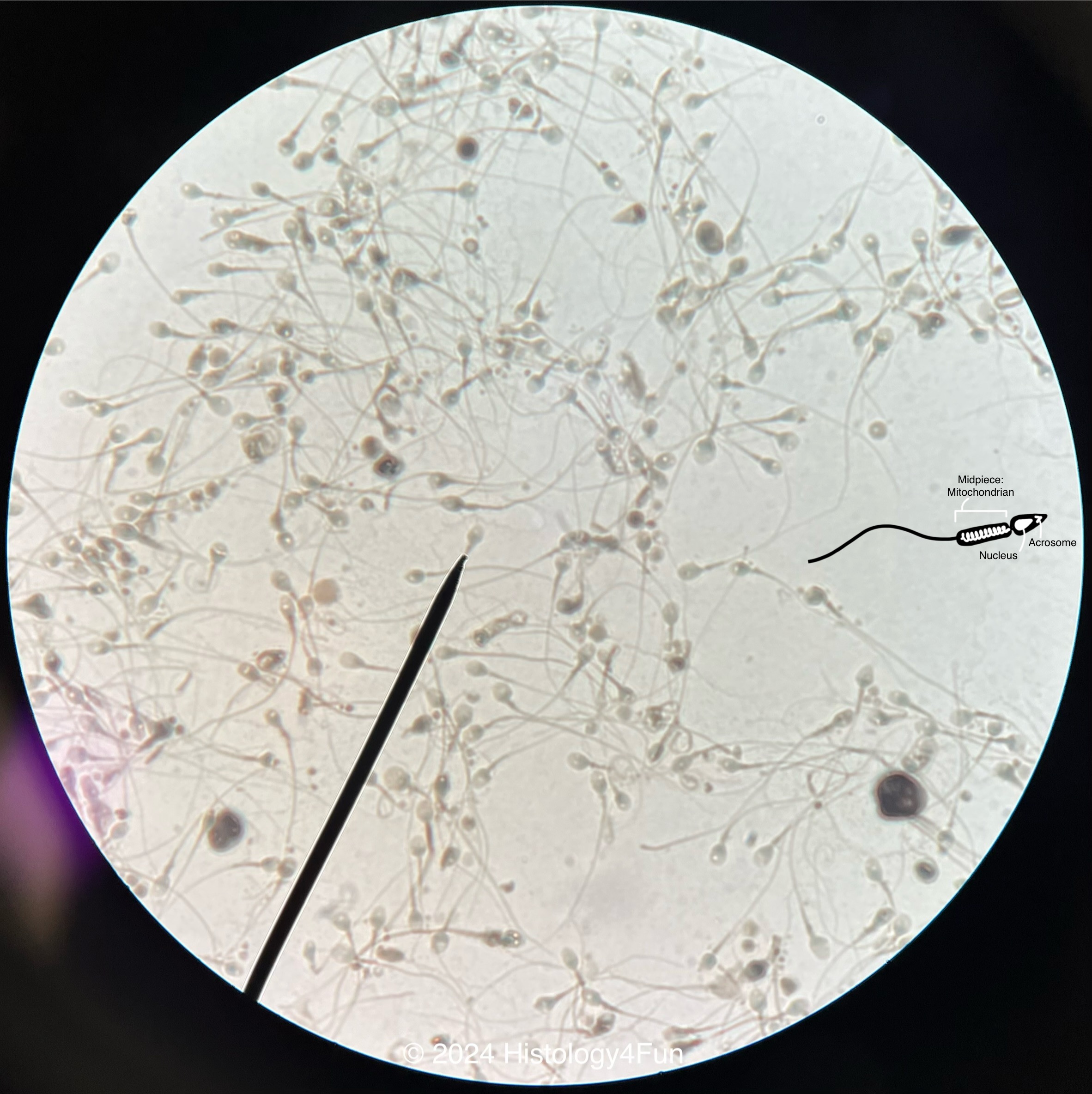 Sperm