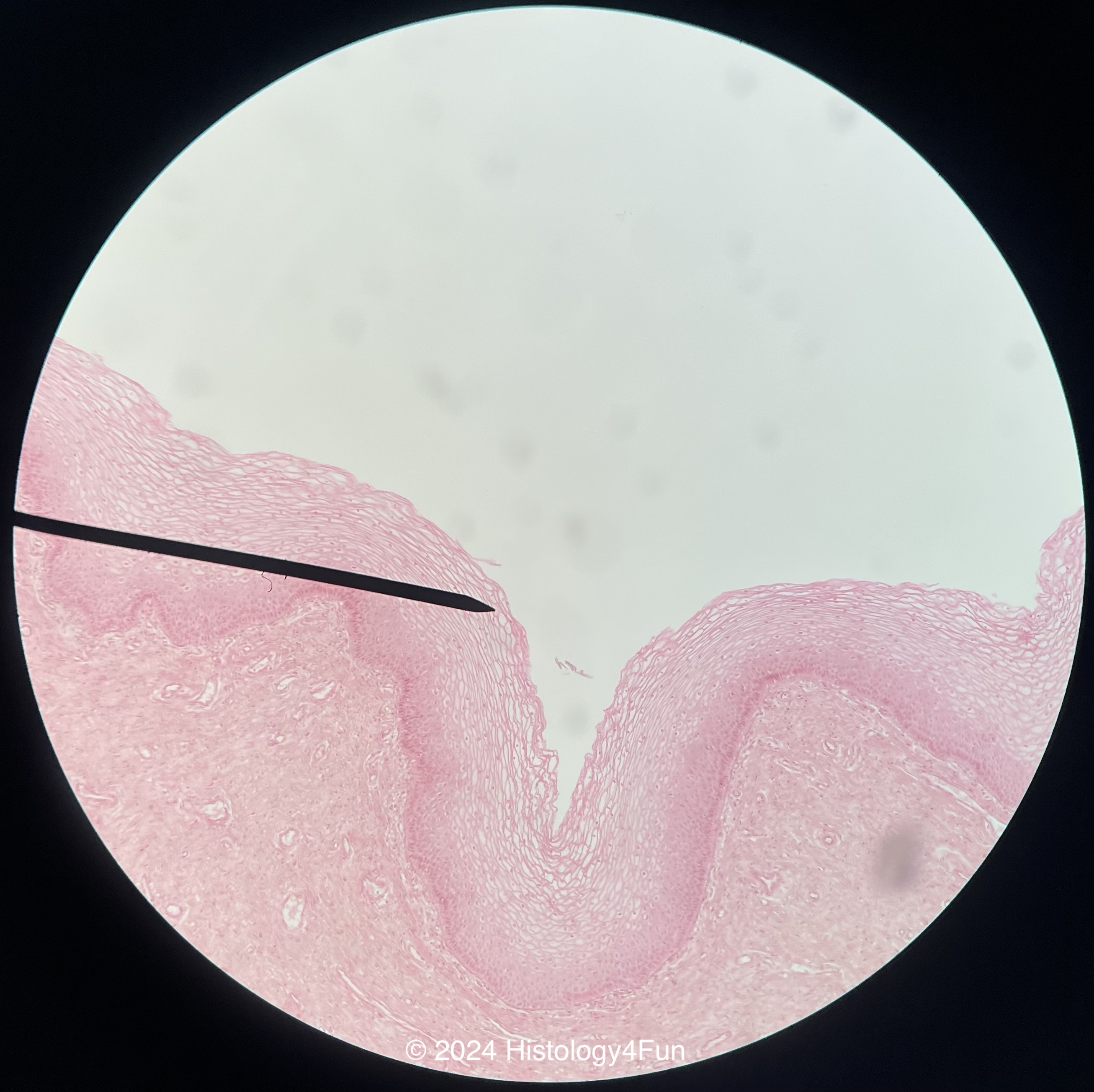 Vagina - Cornified Epithelium 