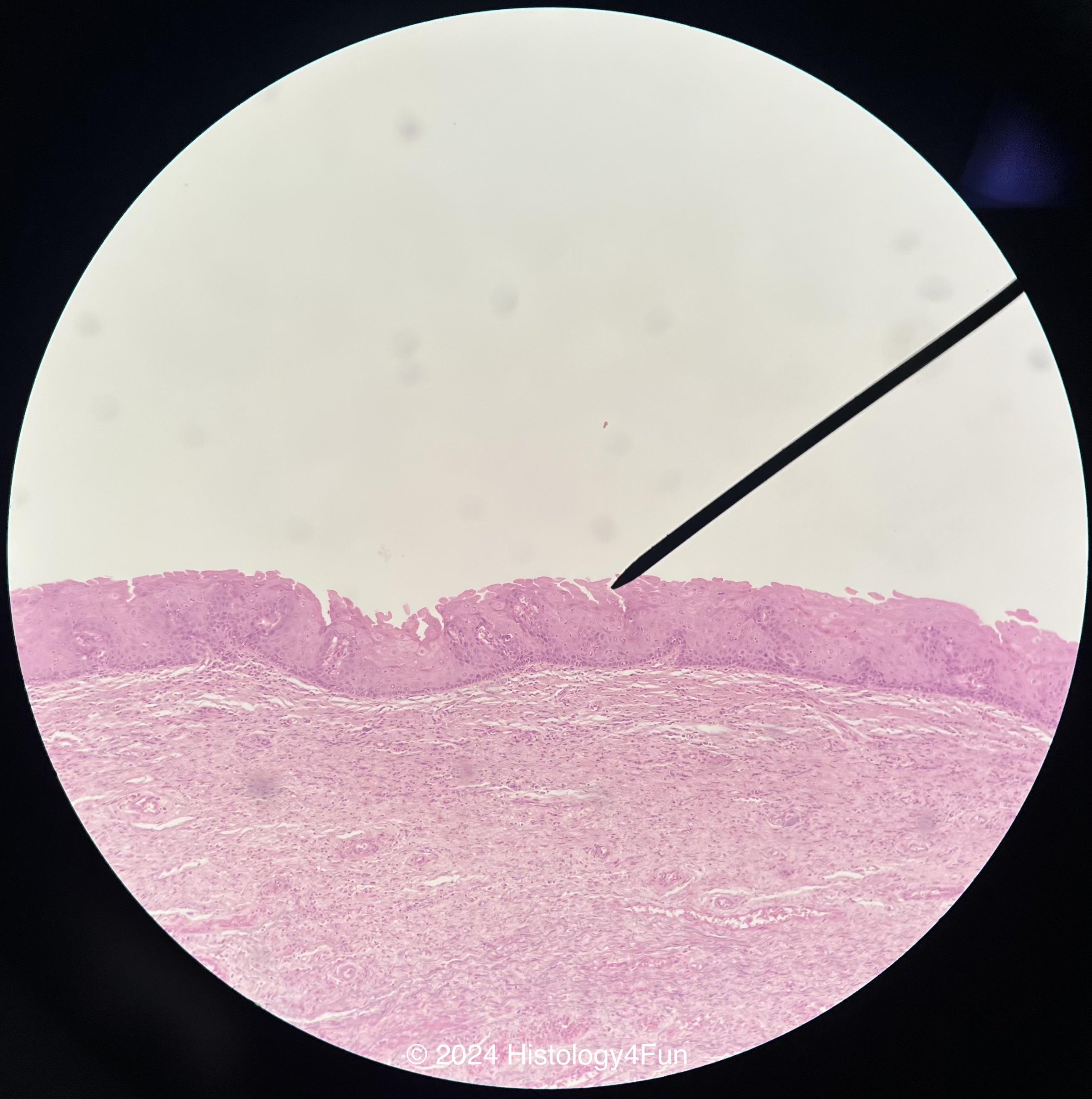 Vagina - Non-cornified Epithelium