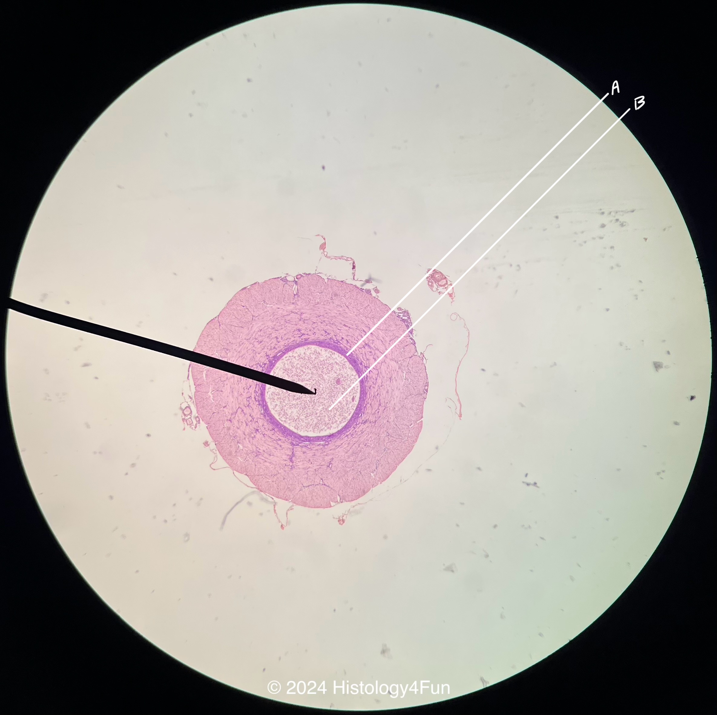 Vas Deferens 